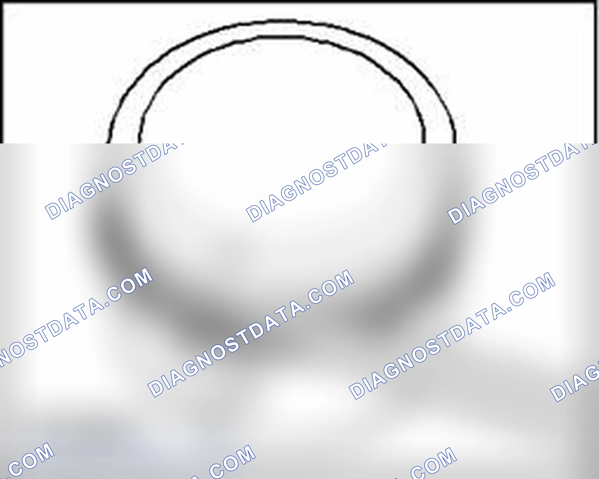 Scheme 245: Measuring piston ring side clearance