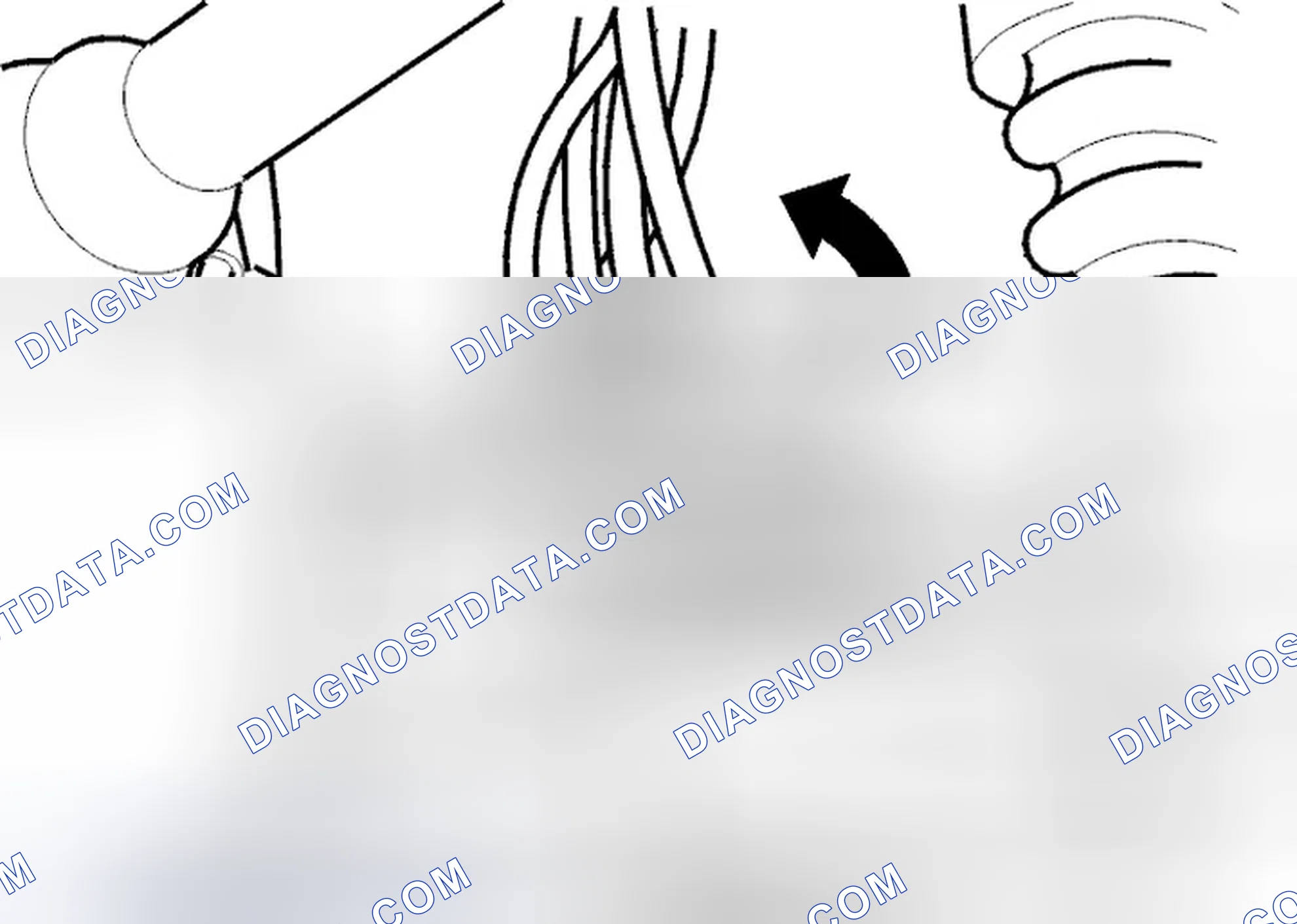 Scheme 505: Removing front bracket