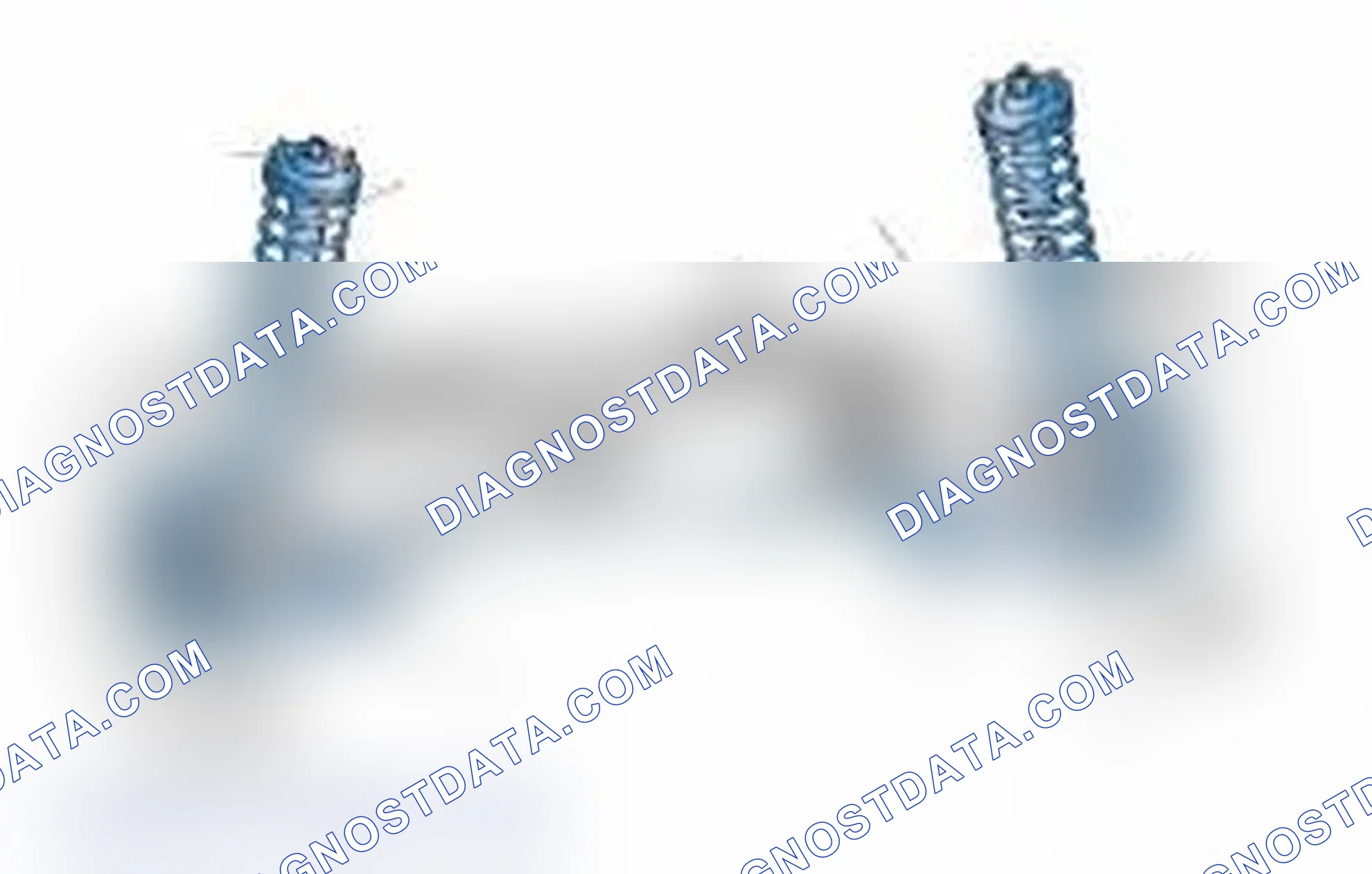Scheme 25: Typical Front Suspension & Steering Components