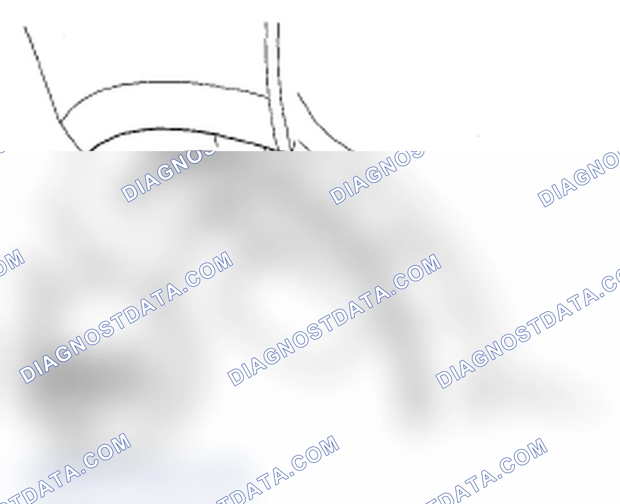 Scheme 8: Rear Wheel Arch Protector Replacement