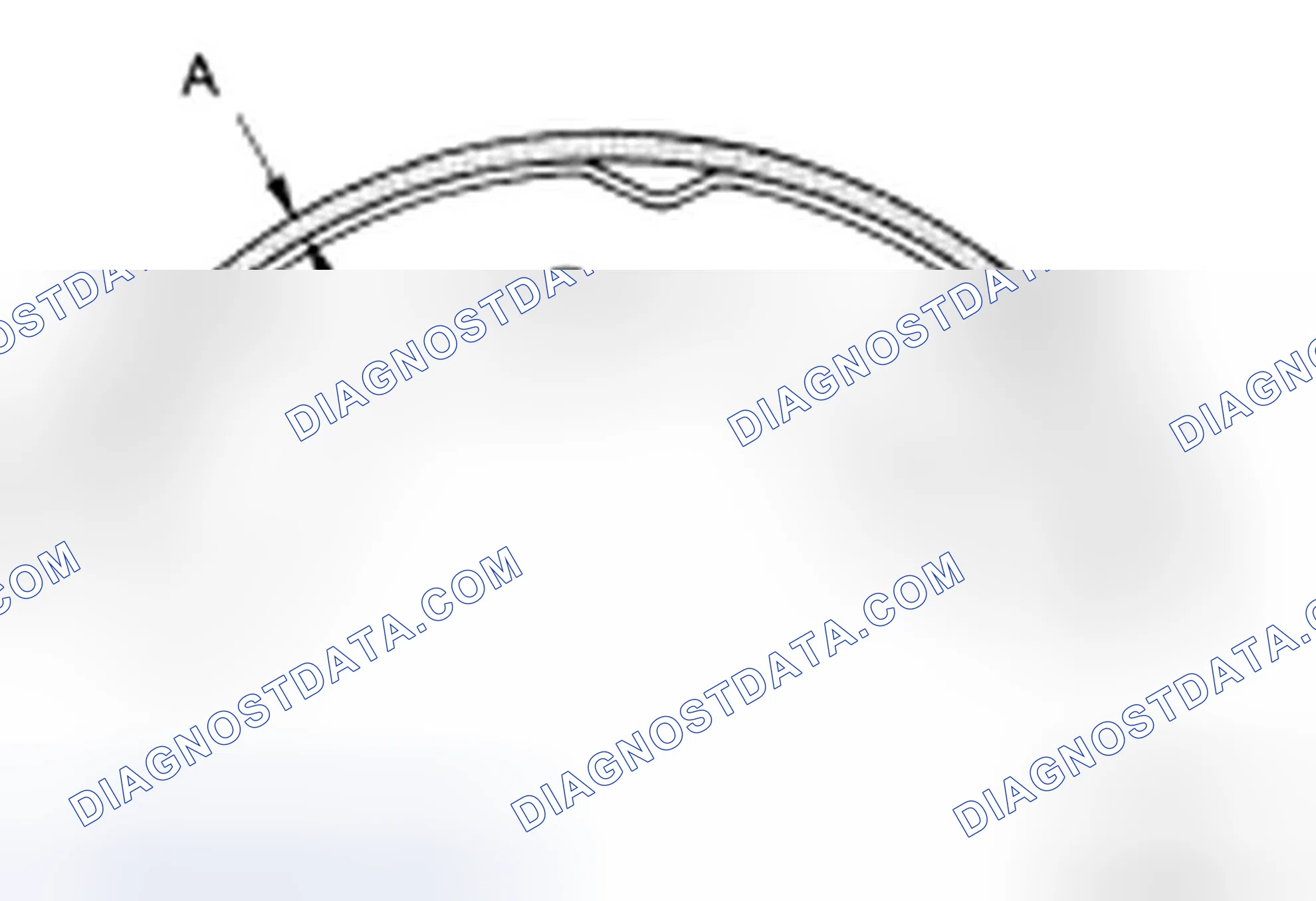 Scheme 59: LINING