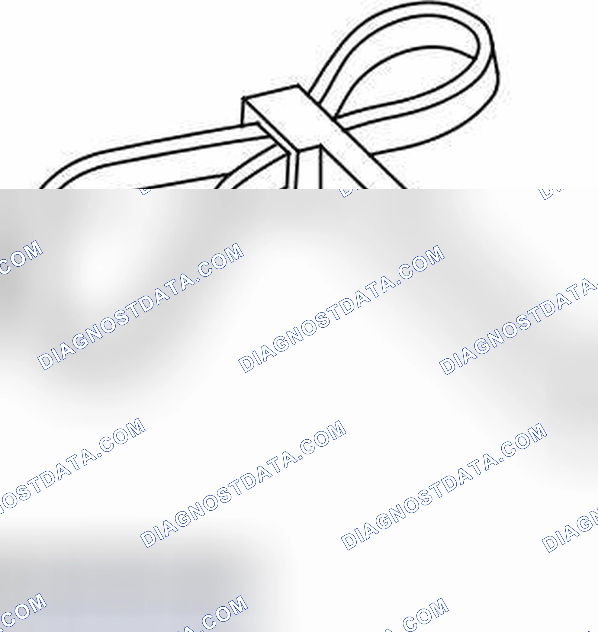 Scheme 154: Crankshaft Pulley - In-Vehicle Procedures