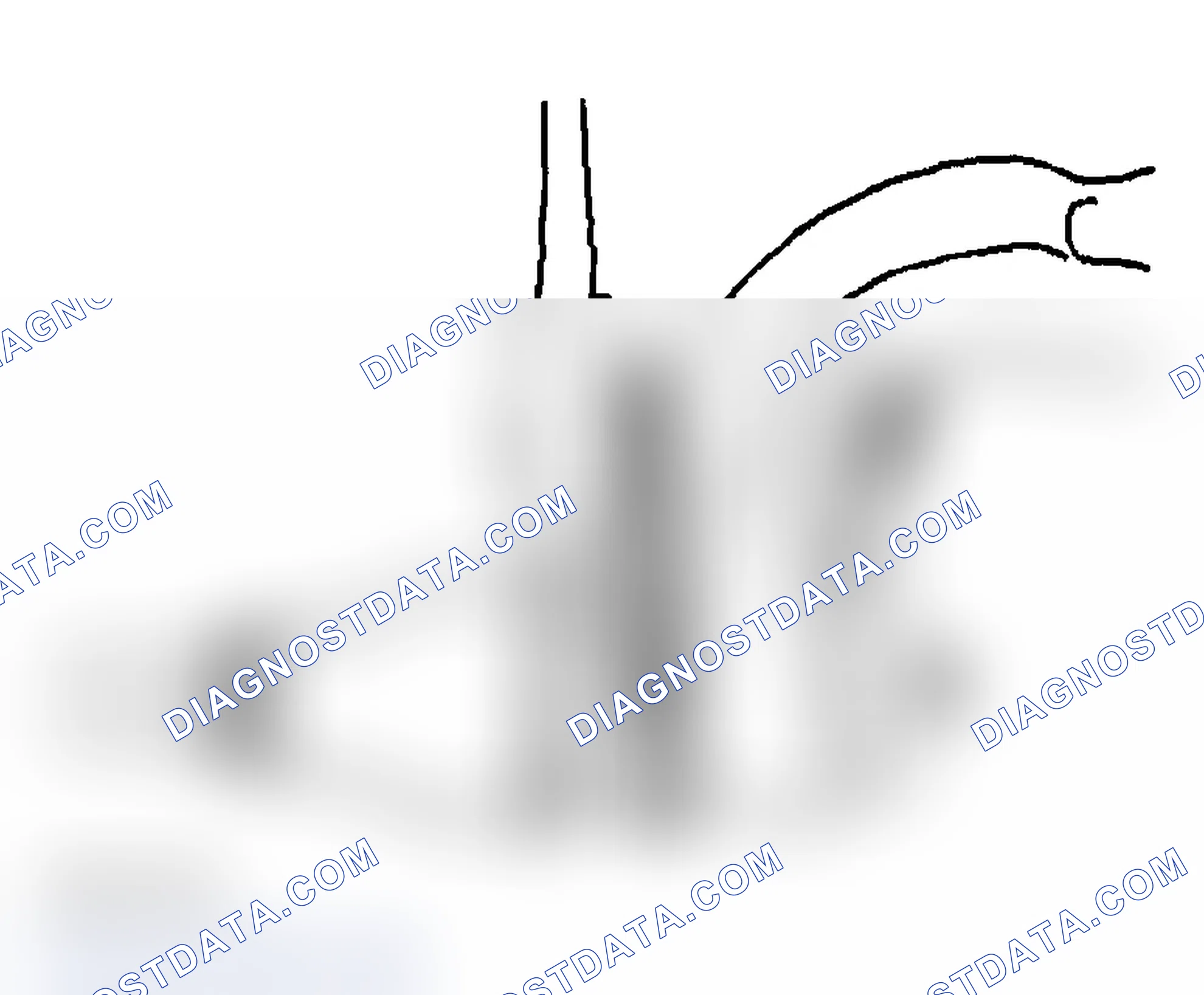 Scheme 17: Removal Procedure