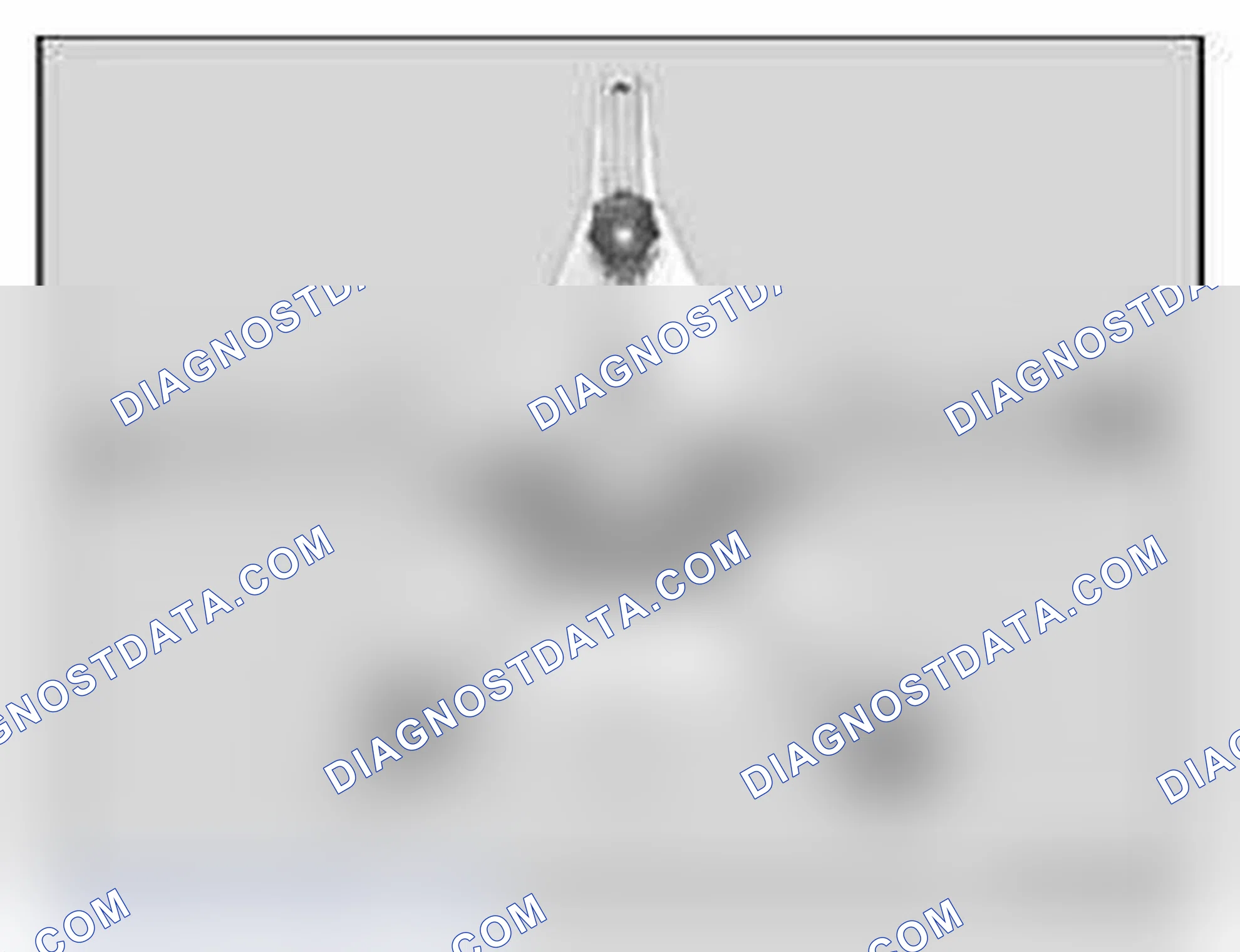Scheme 109: 3.11 Quick-clamping units