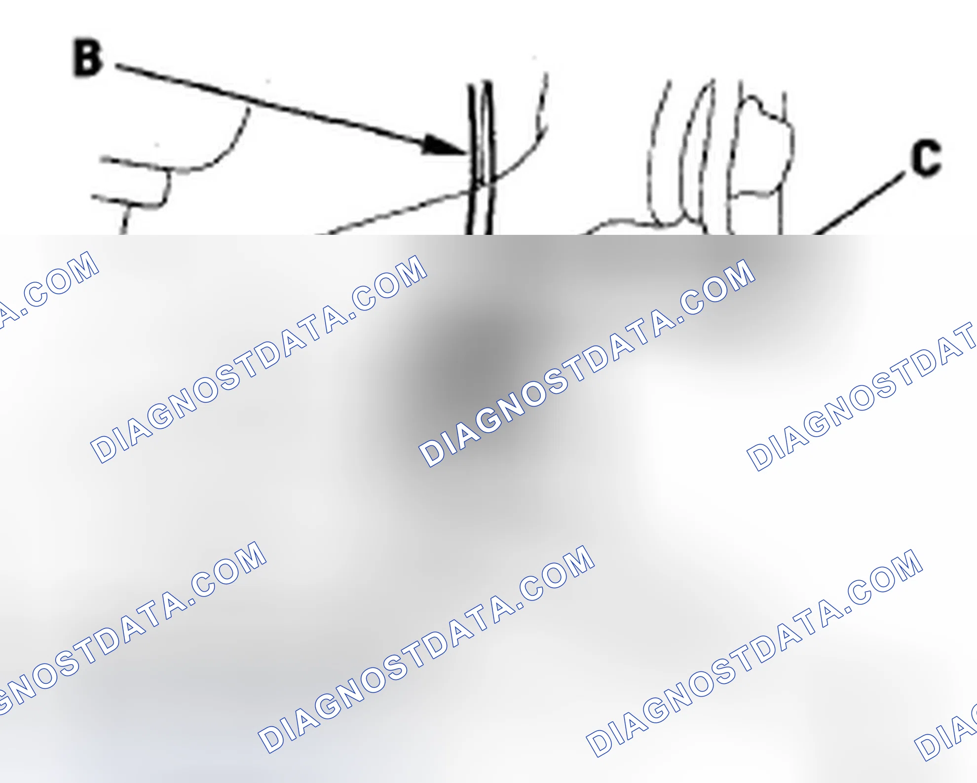 Scheme 39: Brake Hose Replacement