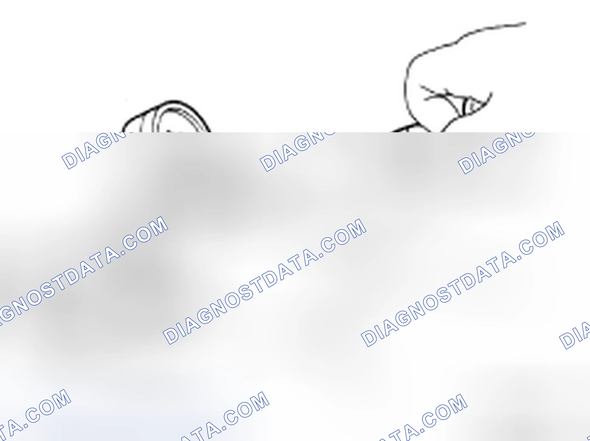 Scheme 72: CHECKING RESERVOIR CAP