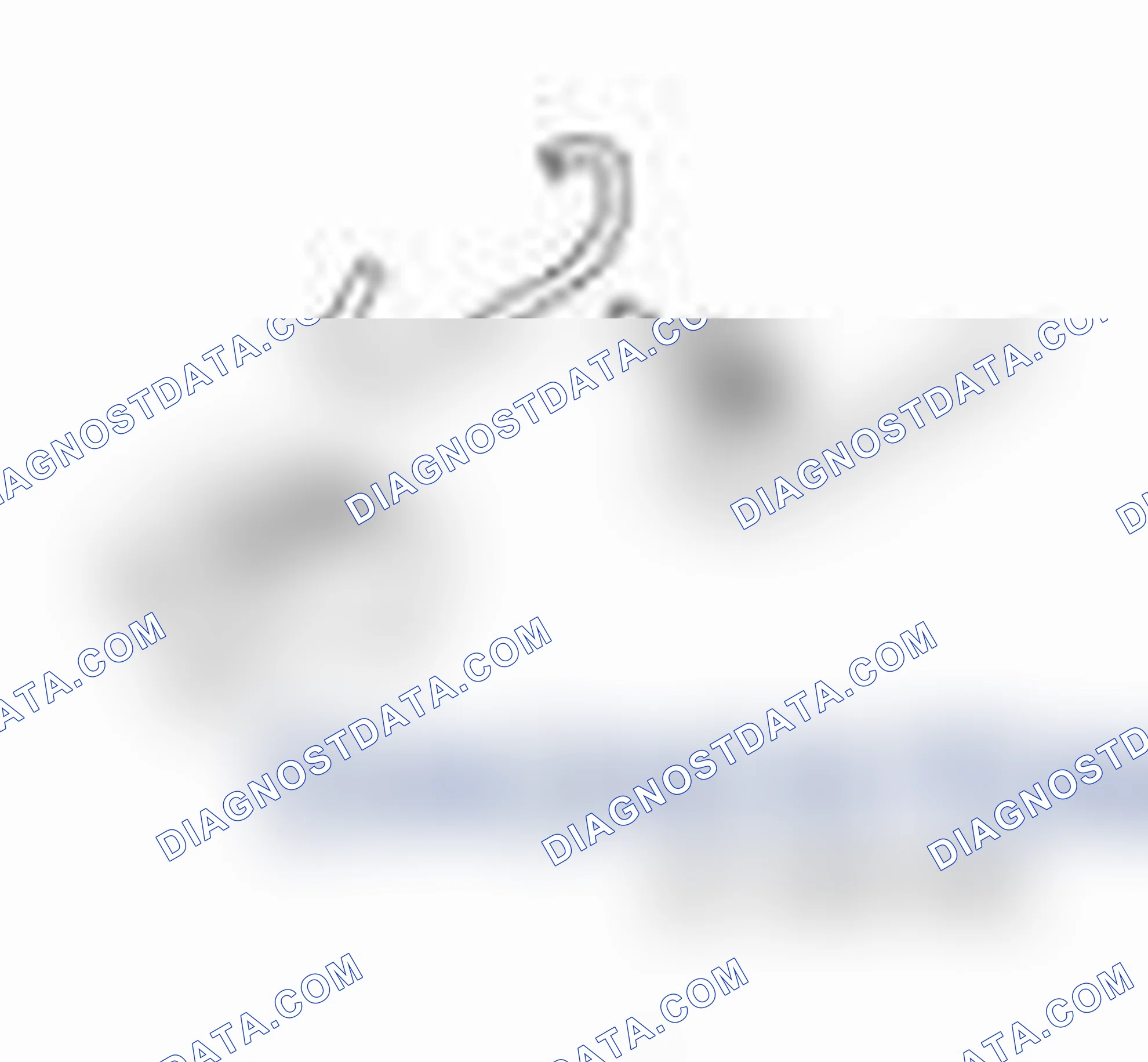 Scheme 11: Air Conditioning (A/C) Compressor Belt