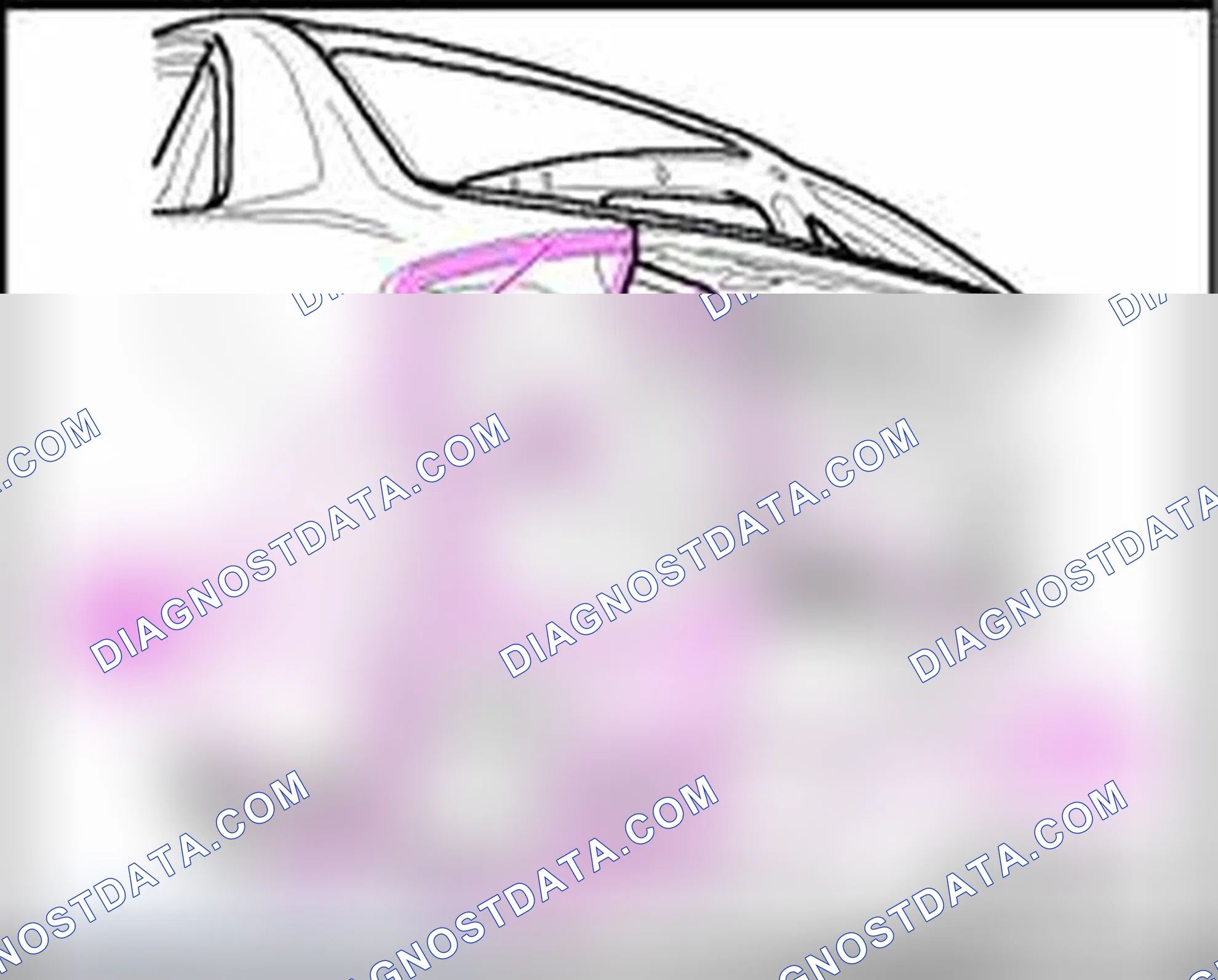 Scheme 134: Welding in
