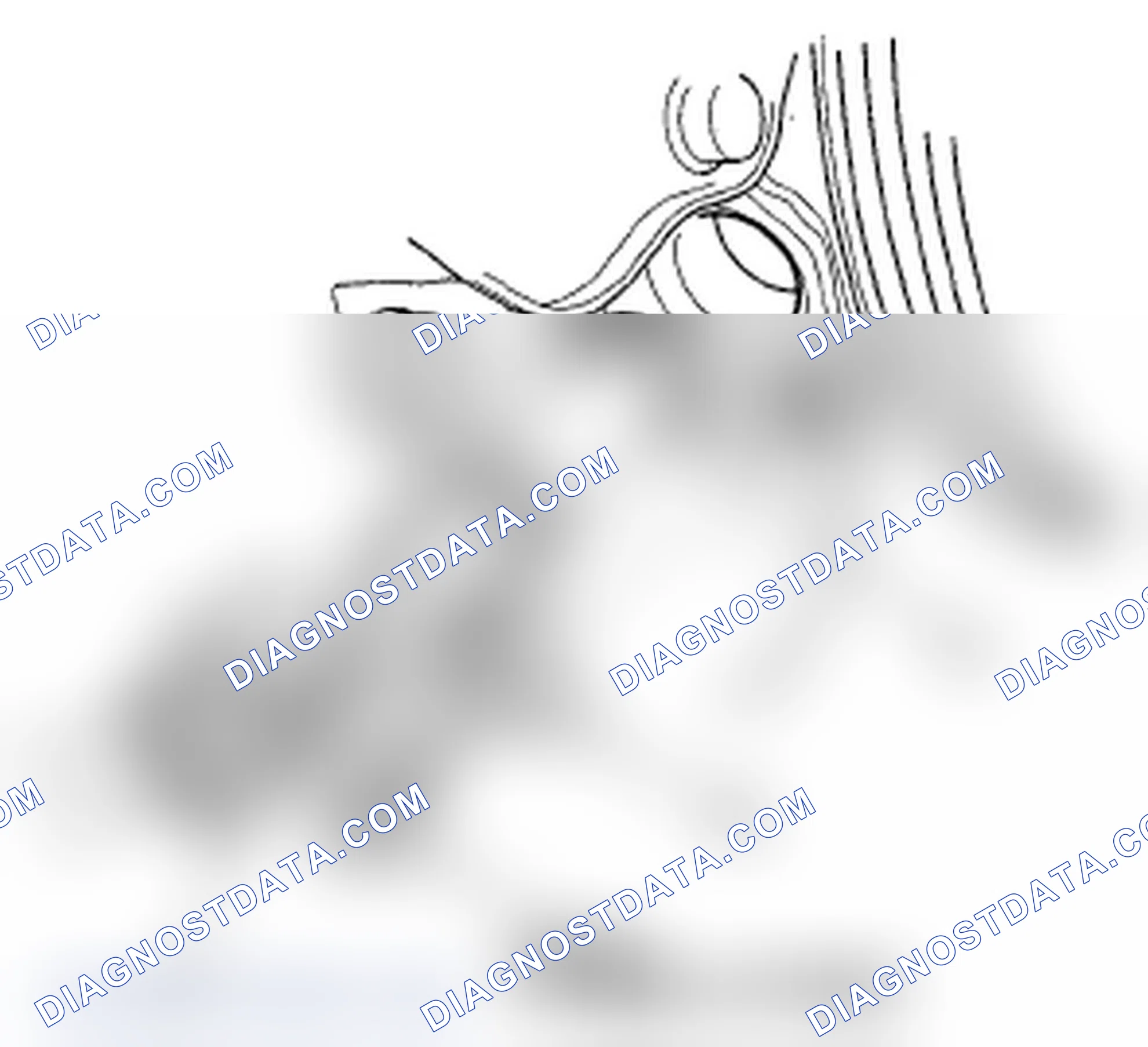 Scheme 221: CKP Sensor Replacement