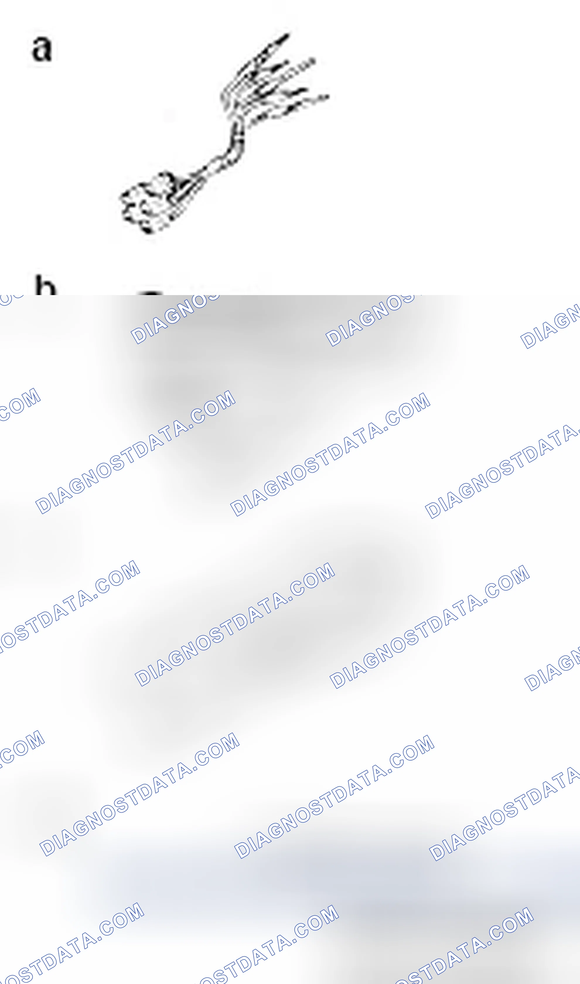 Scheme 4: SPECIAL TOOLS