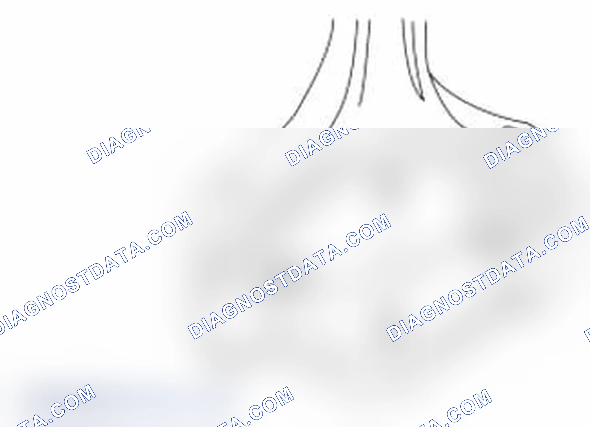 Scheme 440: Connecting Rod Large End Bore