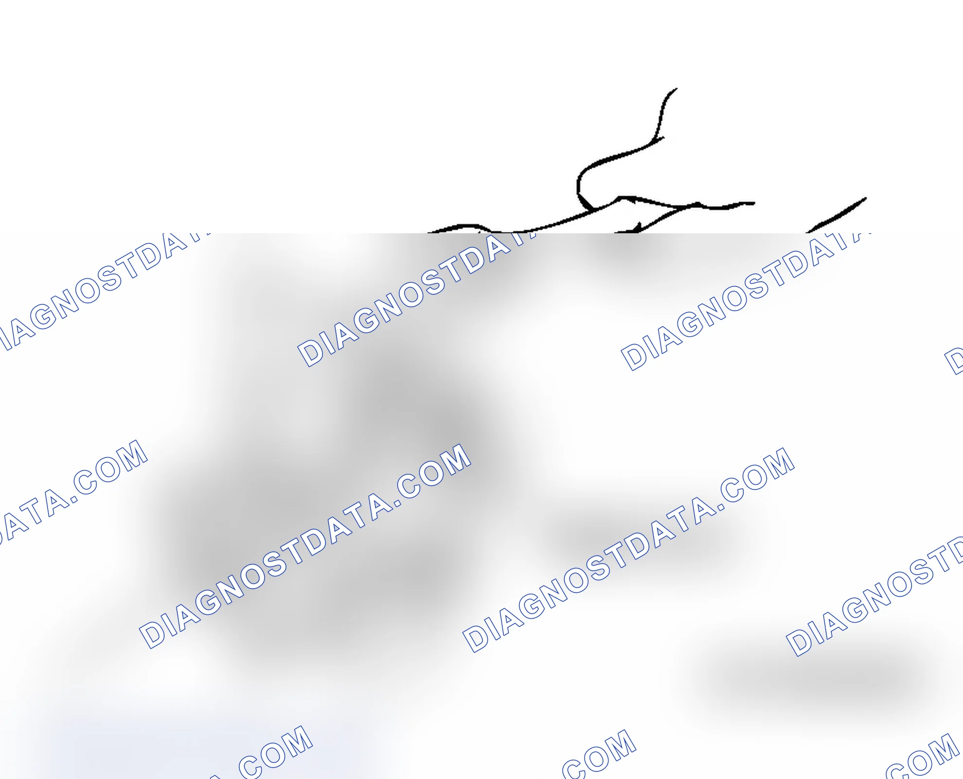 Scheme 161: << A >> RACK SUPPORT COVER REMOVAL
