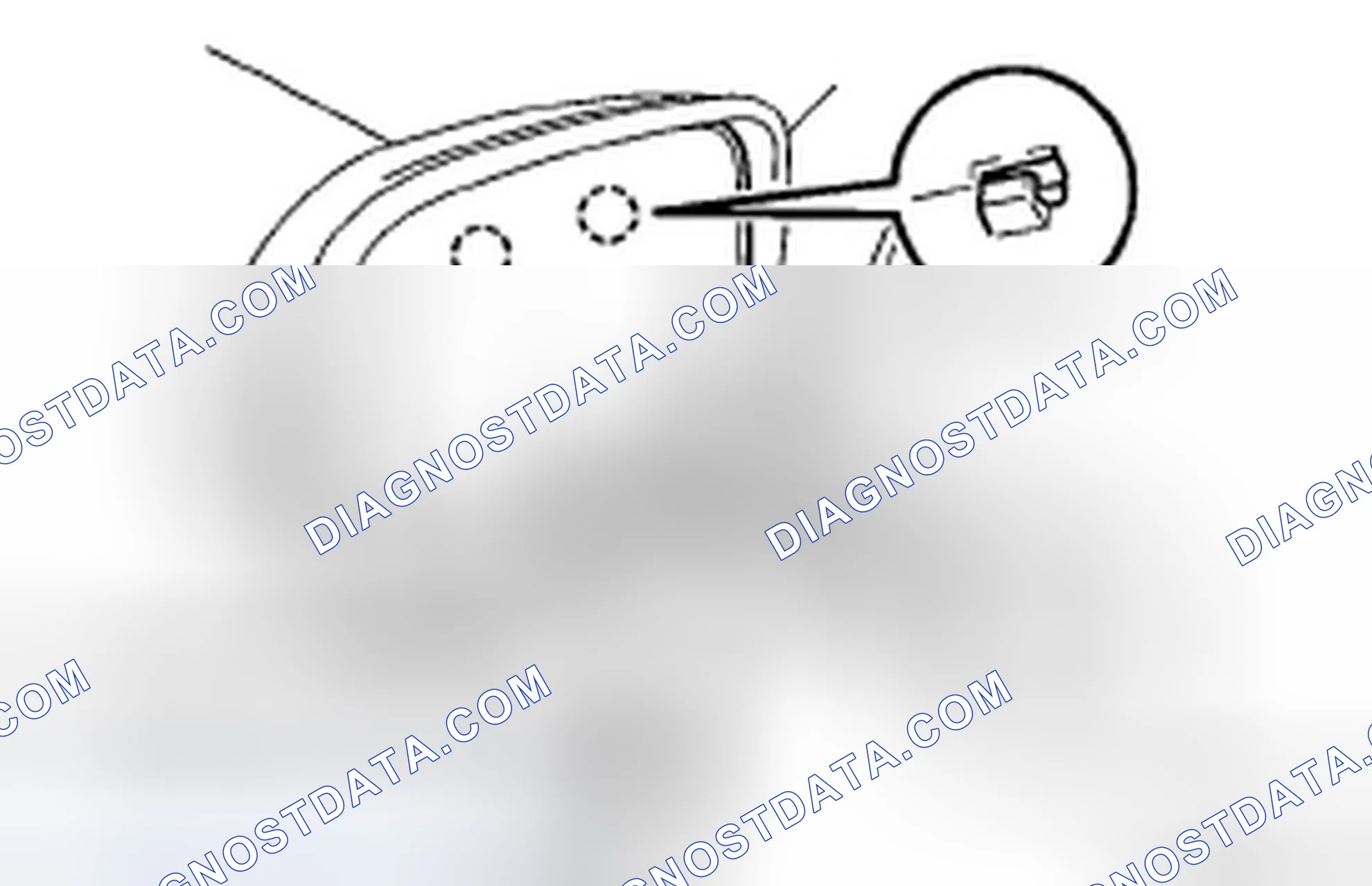 Scheme 15: REMOVAL