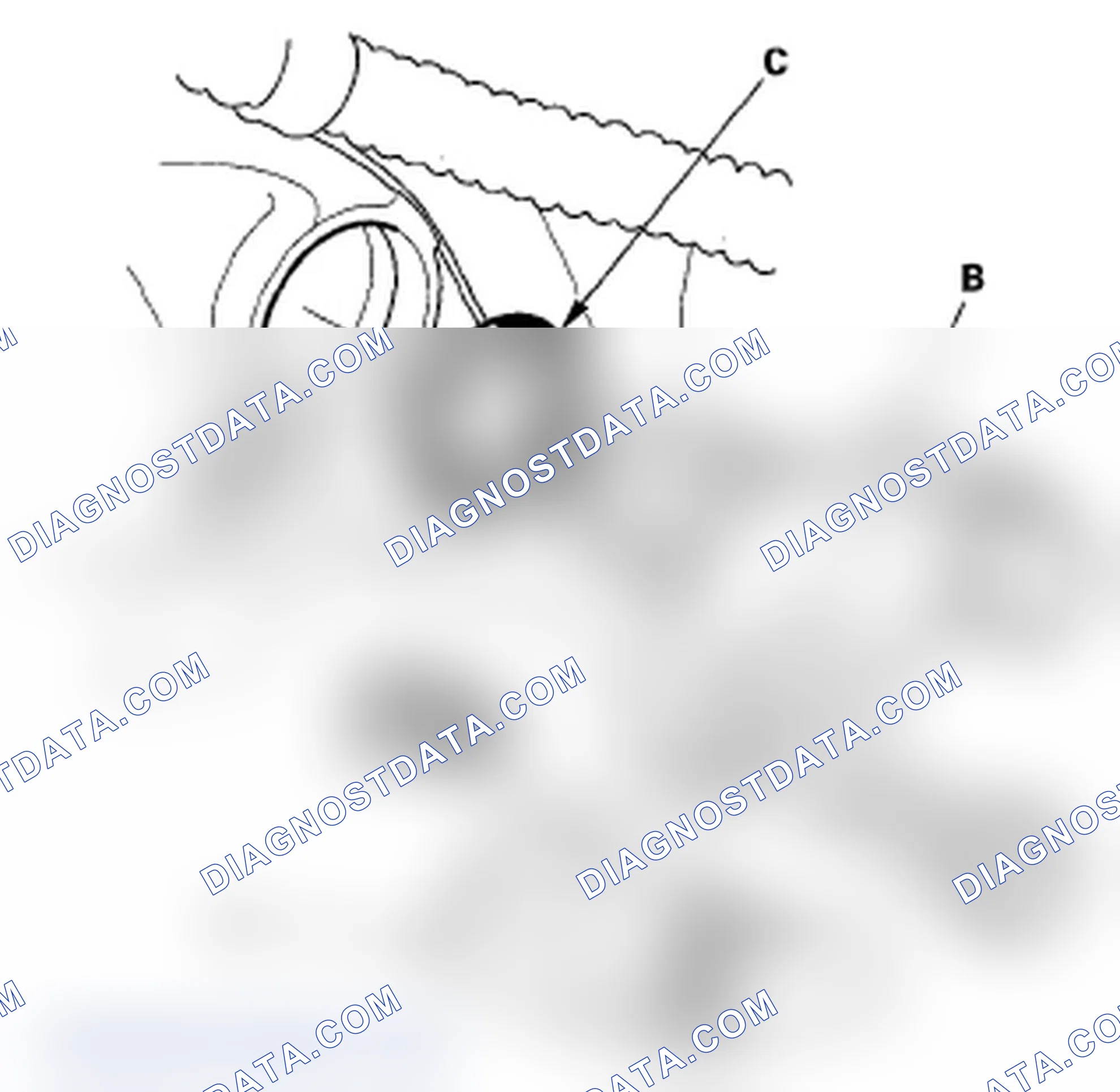 Scheme 218: CMP Sensor B Replacement