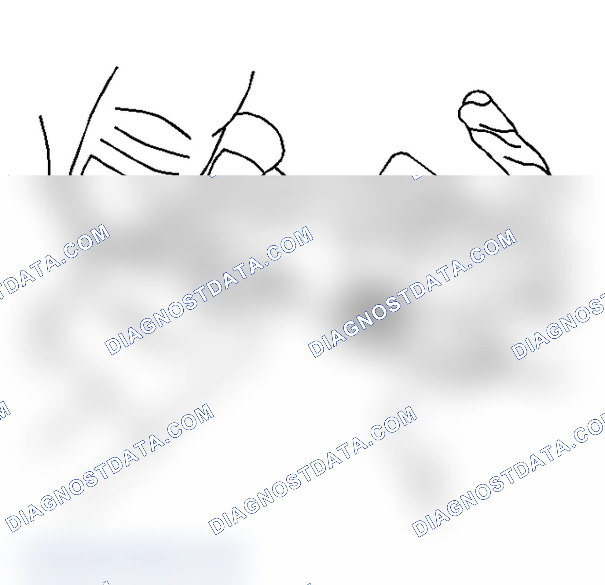 Scheme 32: Removal Procedure