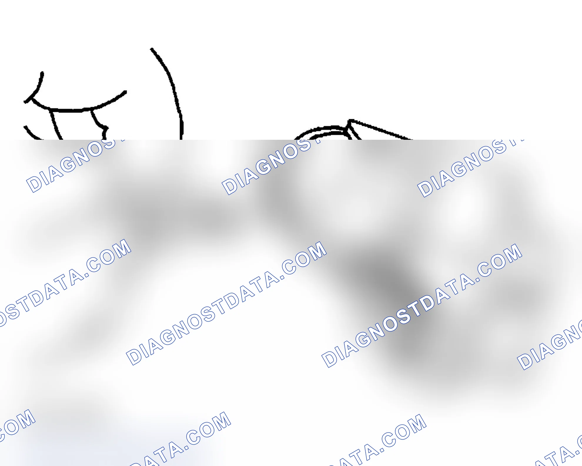 Scheme 280: Installation Procedure