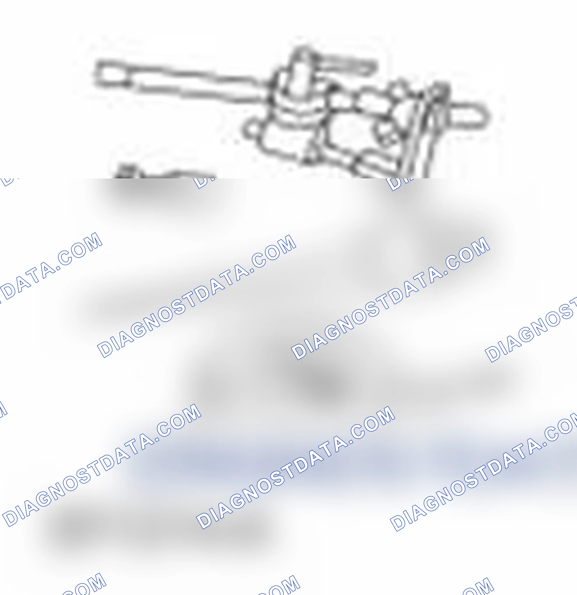 Scheme 1525: Special Tool(s)