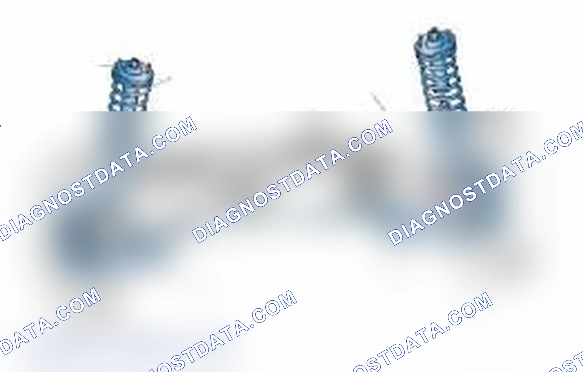 Scheme 25: Typical Front Suspension & Steering Components