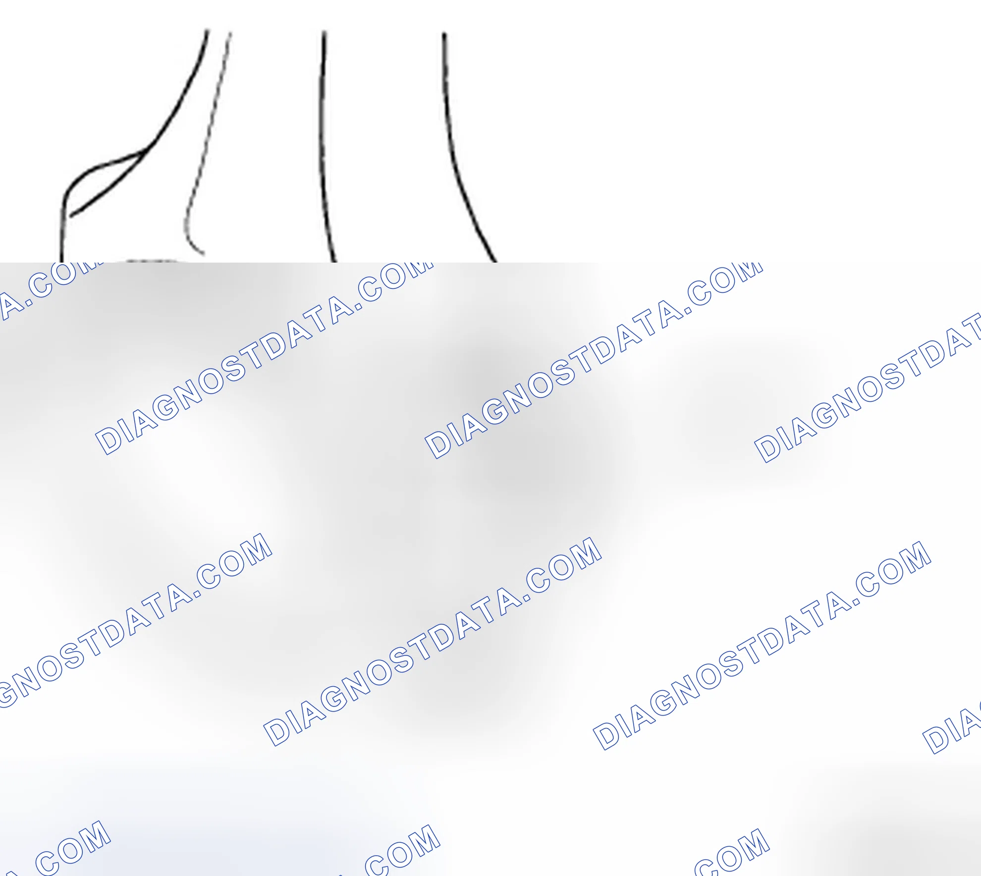 Scheme 108: CONNECTING ROD MARK LOCATION