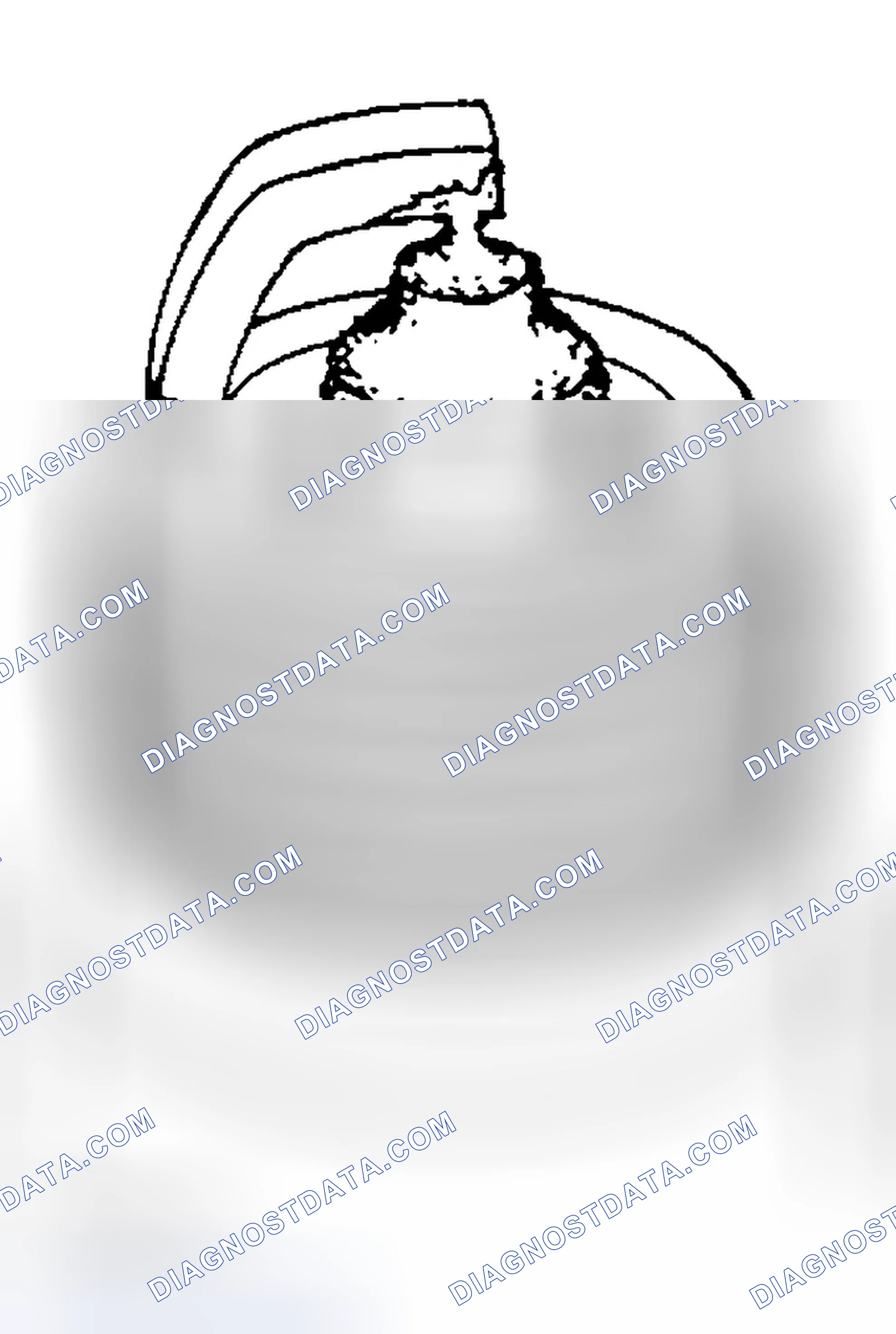 Scheme 81: SPARK PLUG - INSPECTION