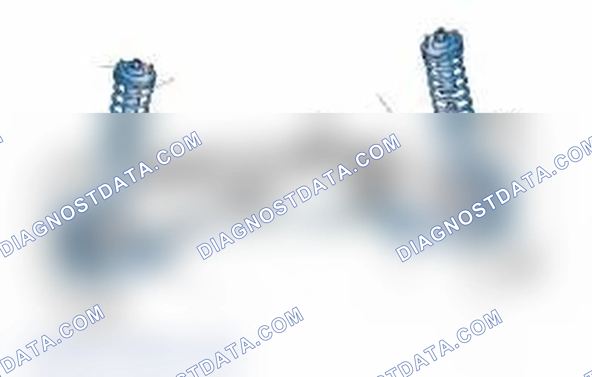 Scheme 25: Typical Front Suspension & Steering Components