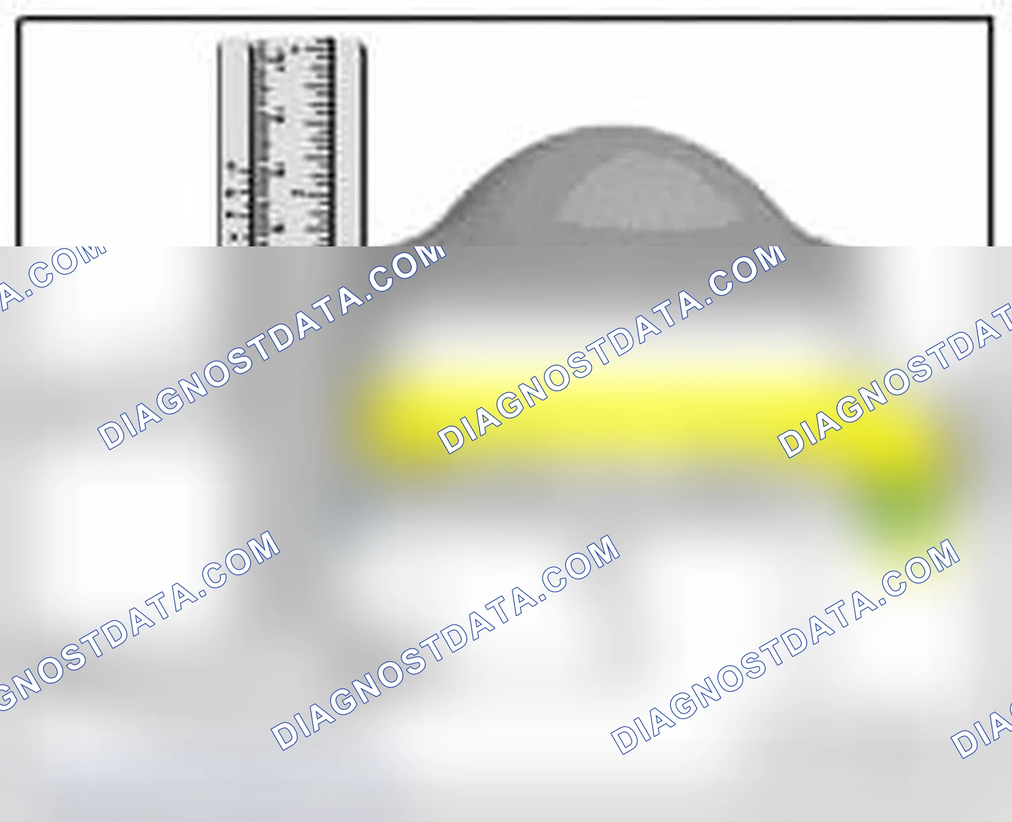Scheme 318