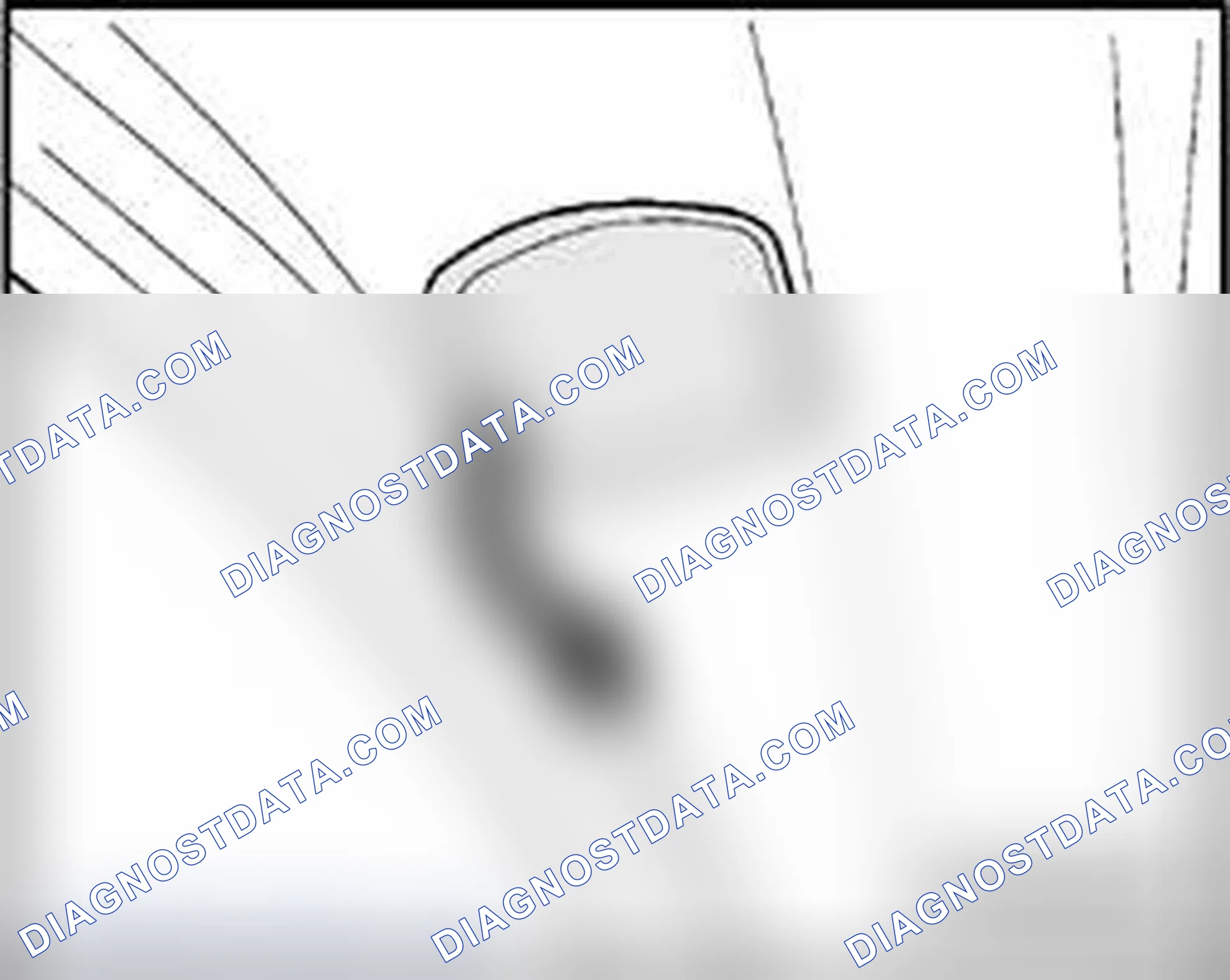 Scheme 140: Washer nozzles, removing and installing