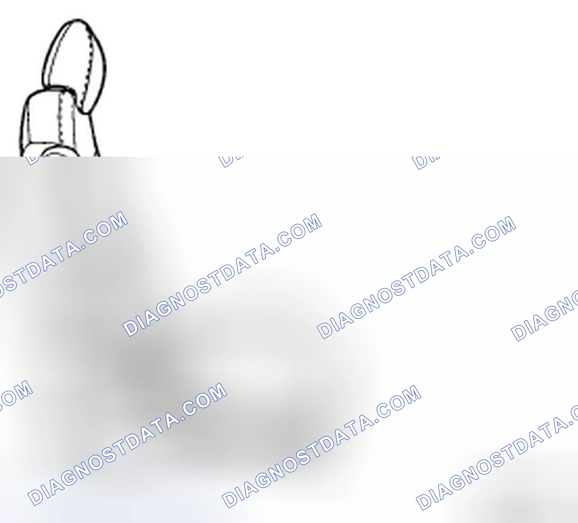 Scheme 53: REMOVAL