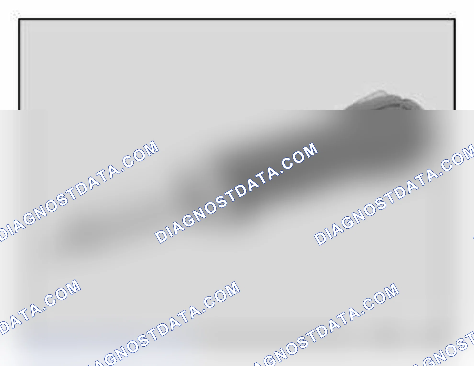 Scheme 1179: Release tool MP