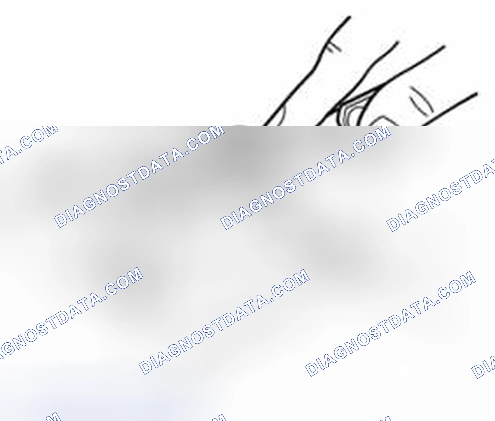 Scheme 191: Big-end side clearance