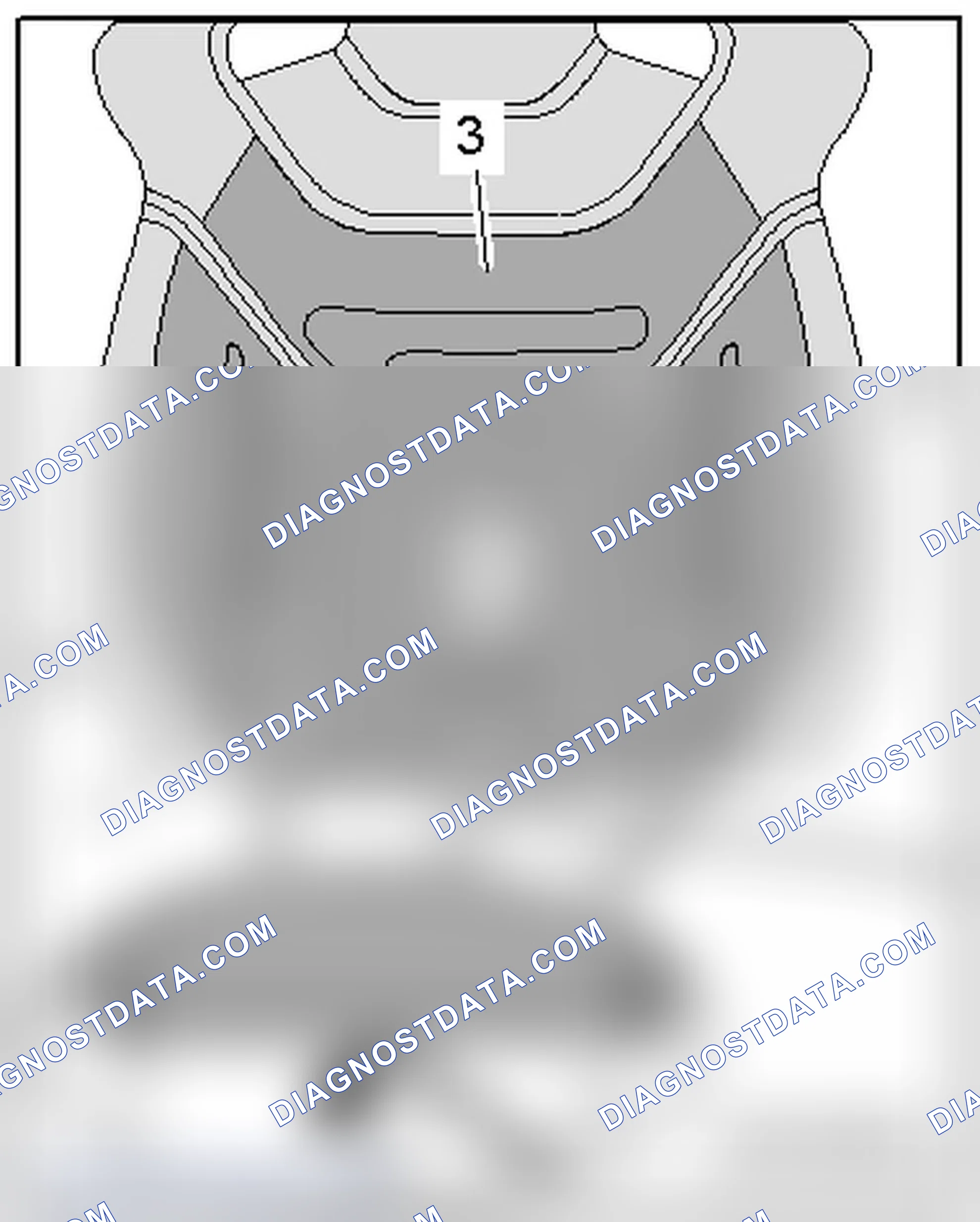 Scheme 403: REMOVING