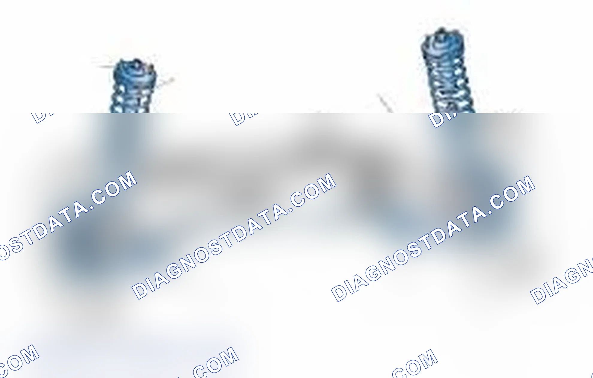 Scheme 25: Typical Front Suspension & Steering Components