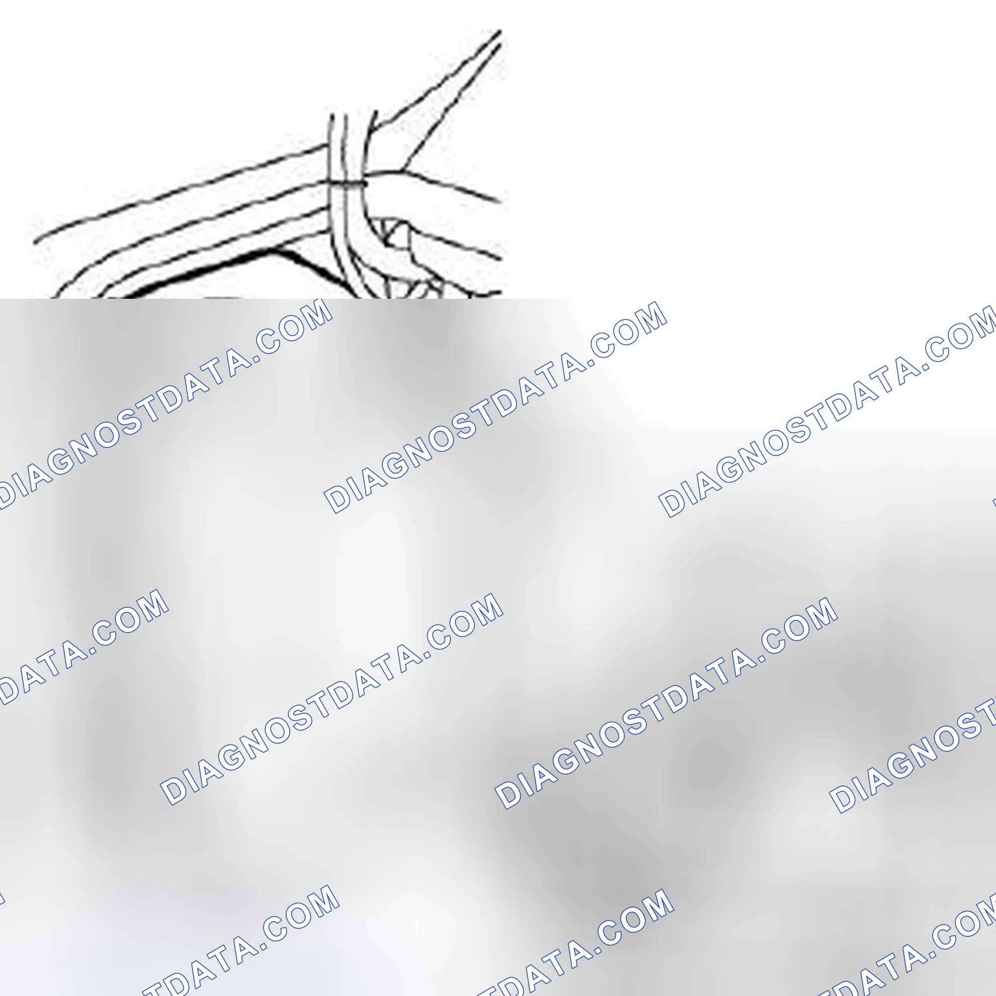 Scheme 1: To remove