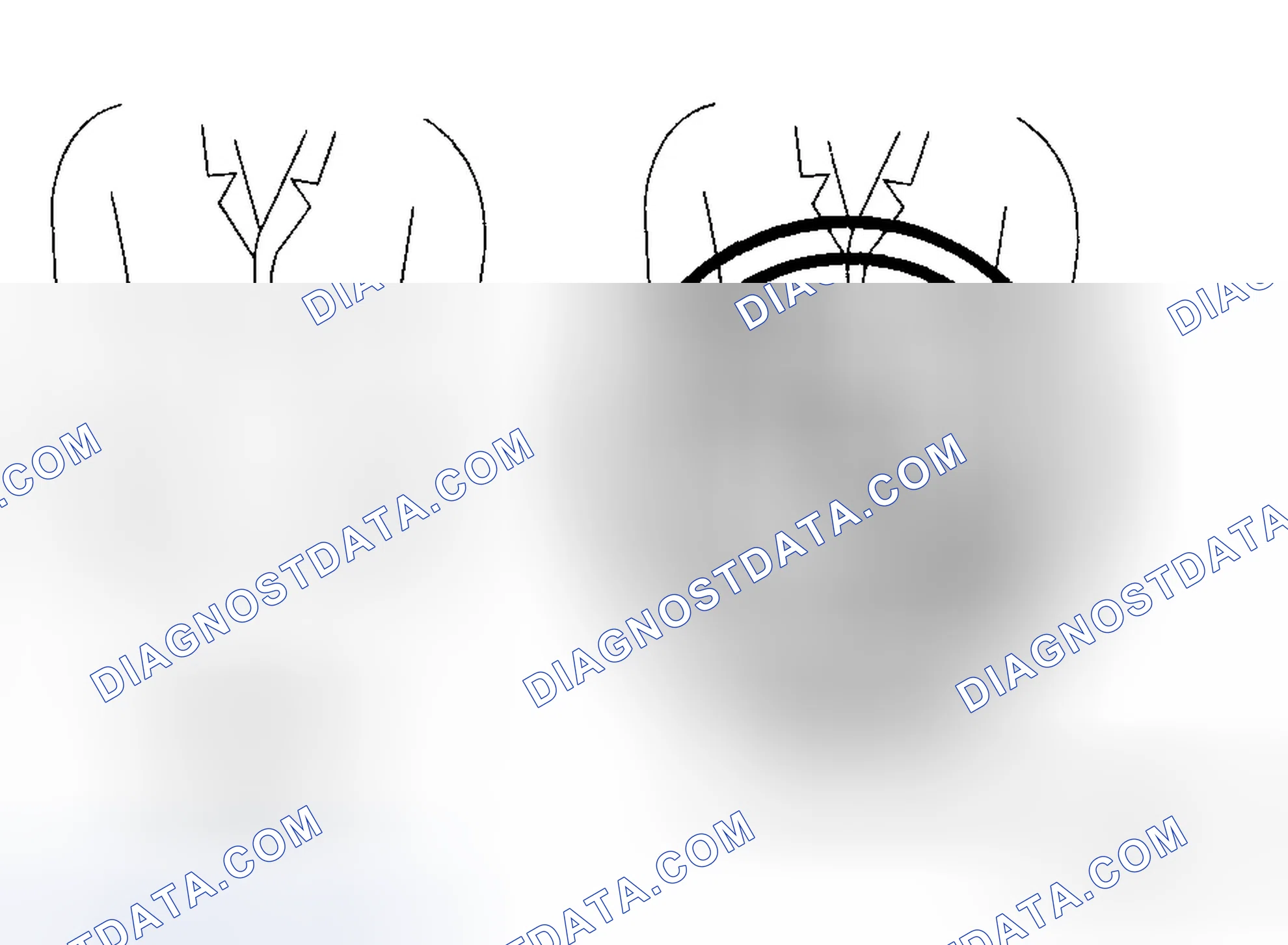 Scheme 3: Air Bag Module Handling