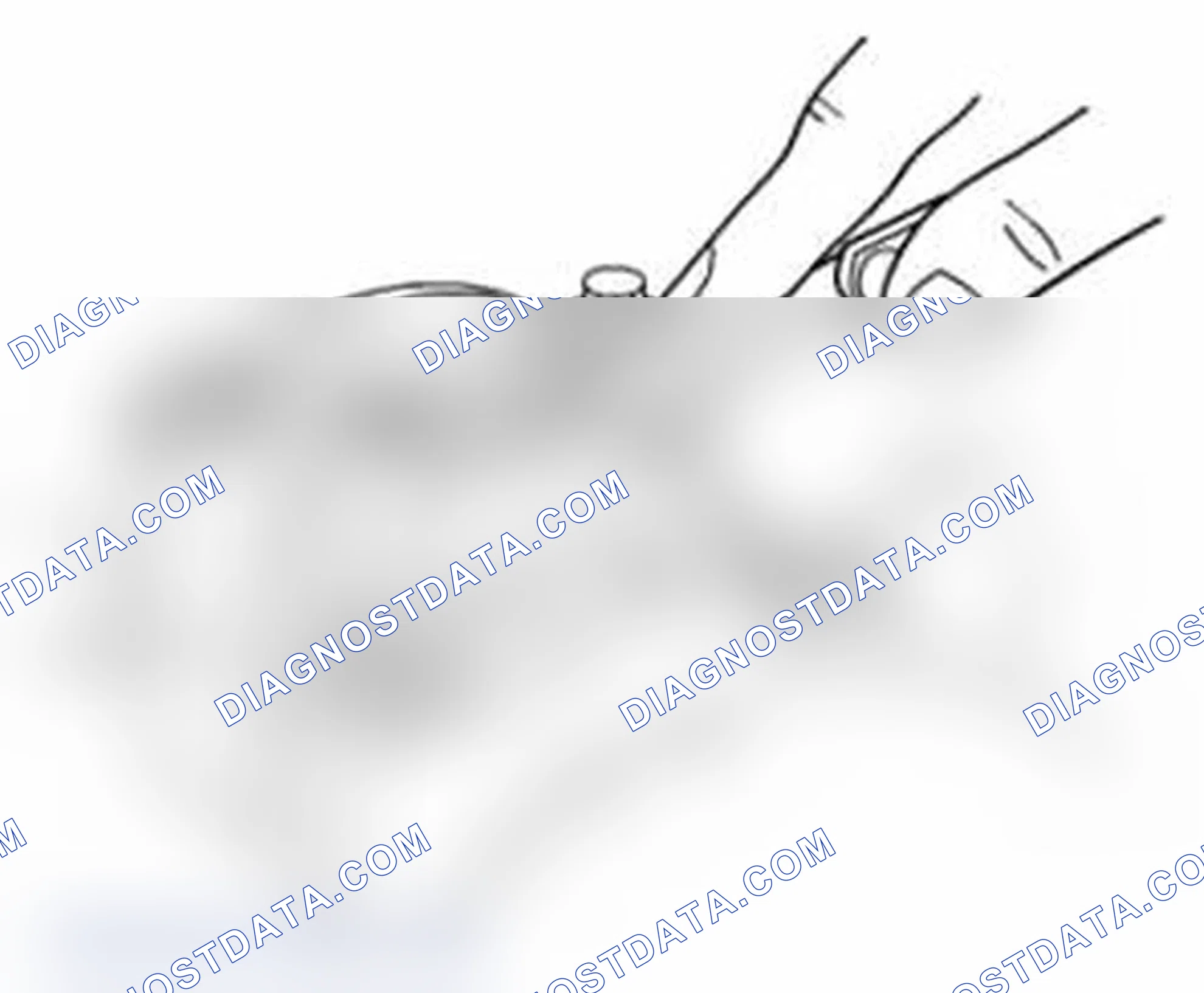 Scheme 451: Big-end side clearance