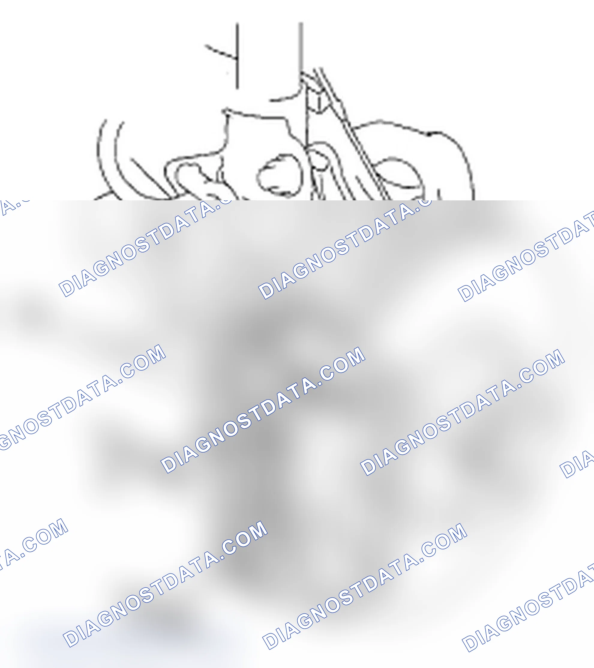 Scheme 17: Inspection