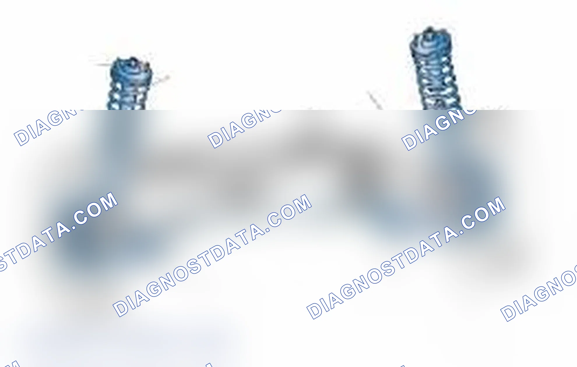 Scheme 25: Typical Front Suspension & Steering Components