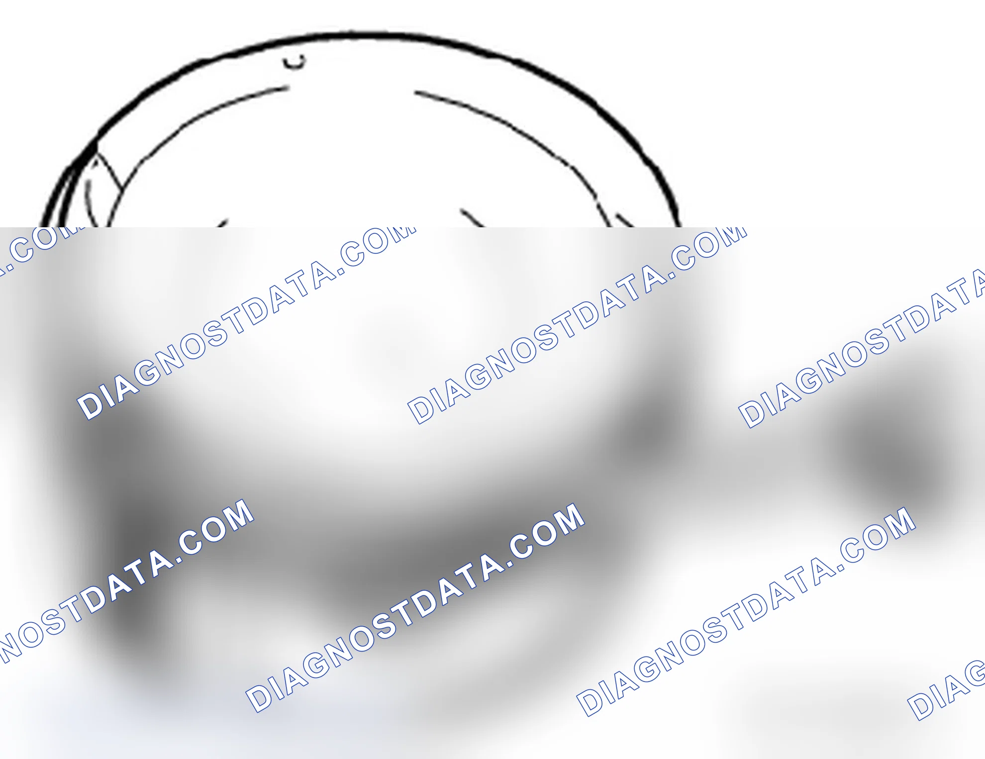 Scheme 35: Piston Ring Measurements