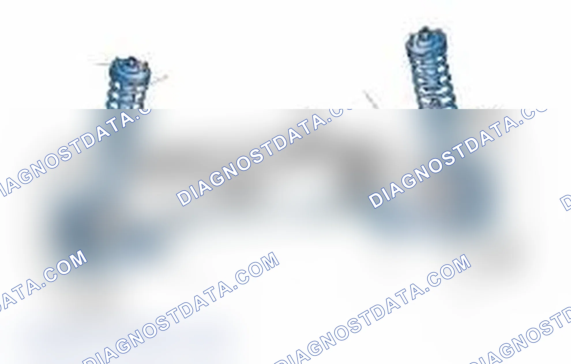Scheme 25: Typical Front Suspension & Steering Components