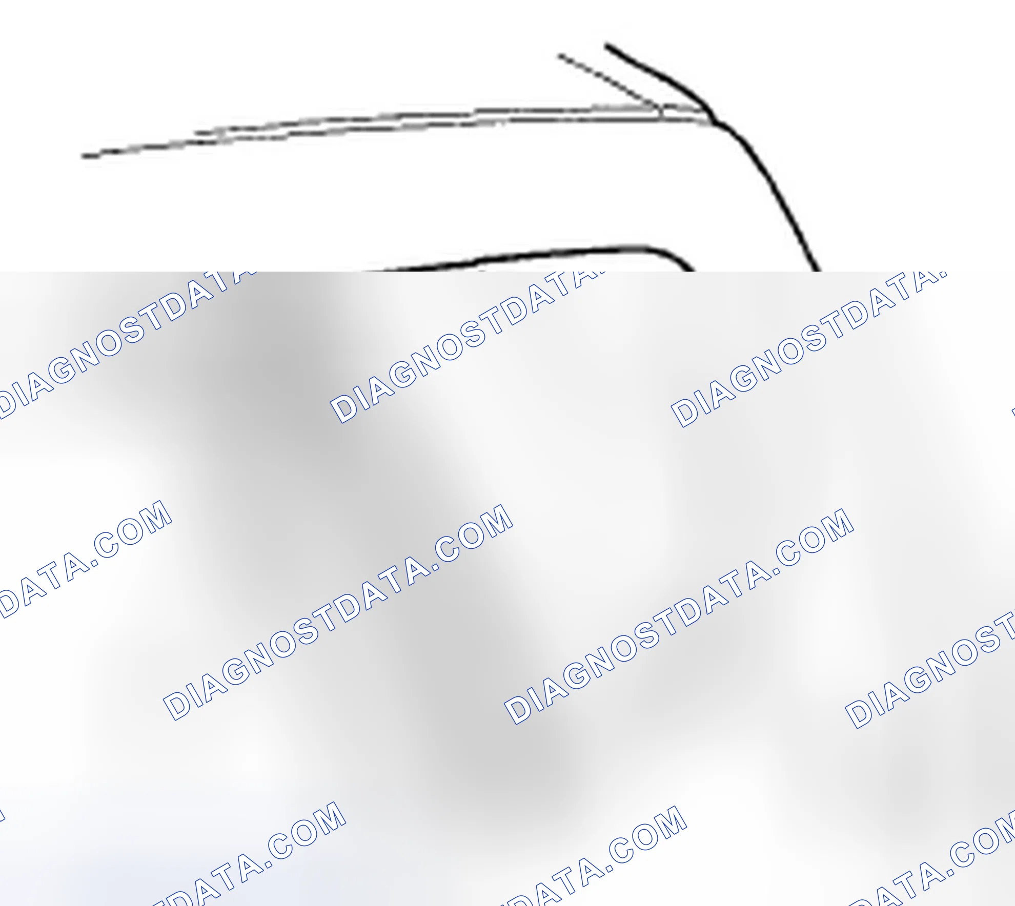 Scheme 35: Quarter Glass Replacement