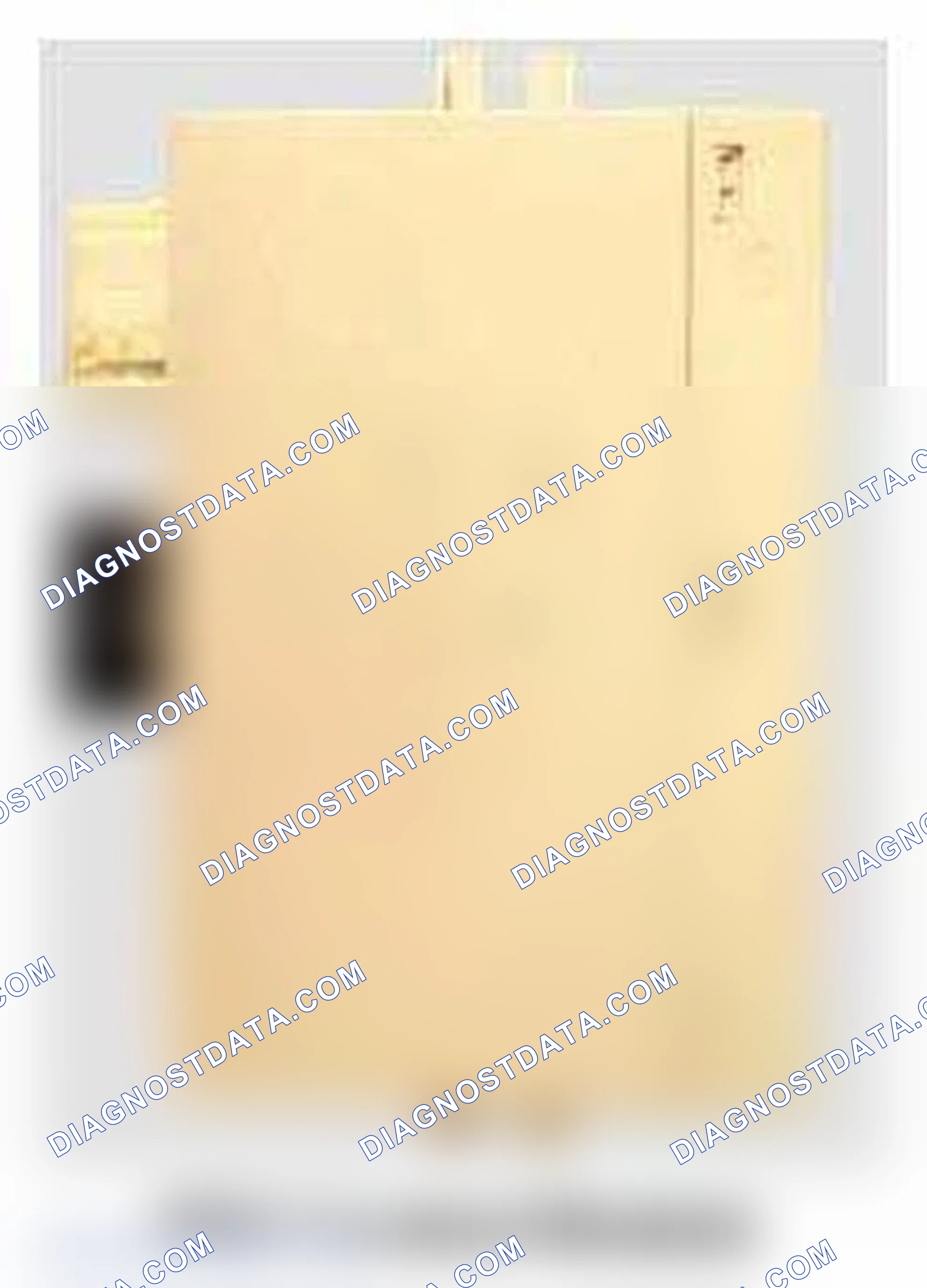 Scheme 162: PDC Control Unit