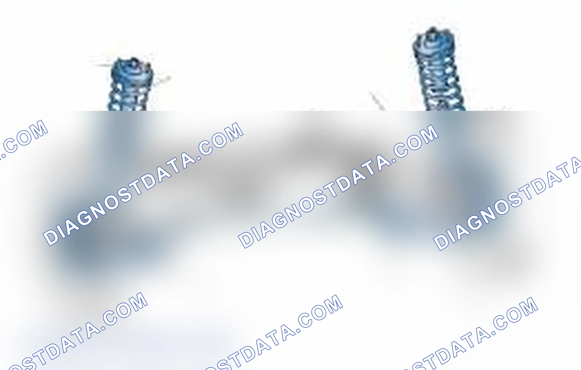 Scheme 25: Typical Front Suspension & Steering Components