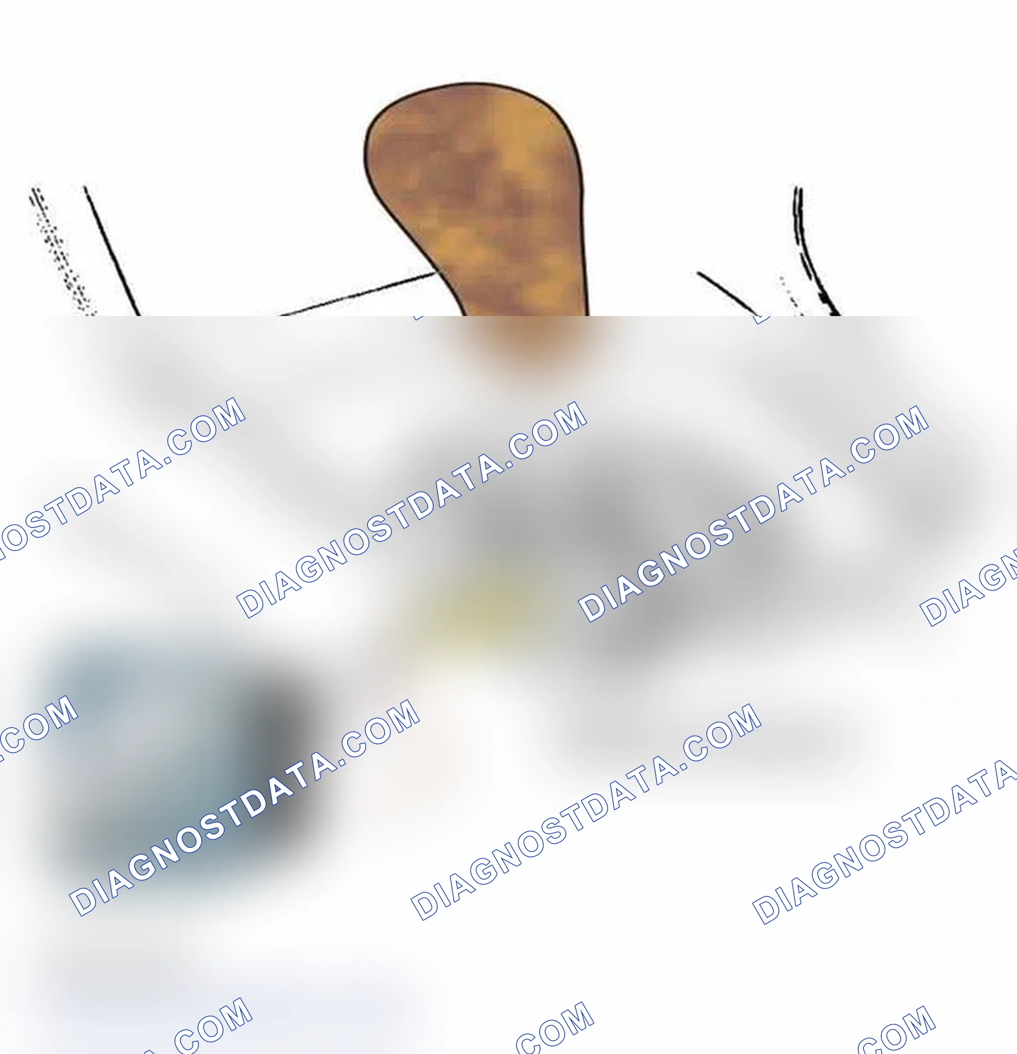 Scheme 170: SHIFT LOCK