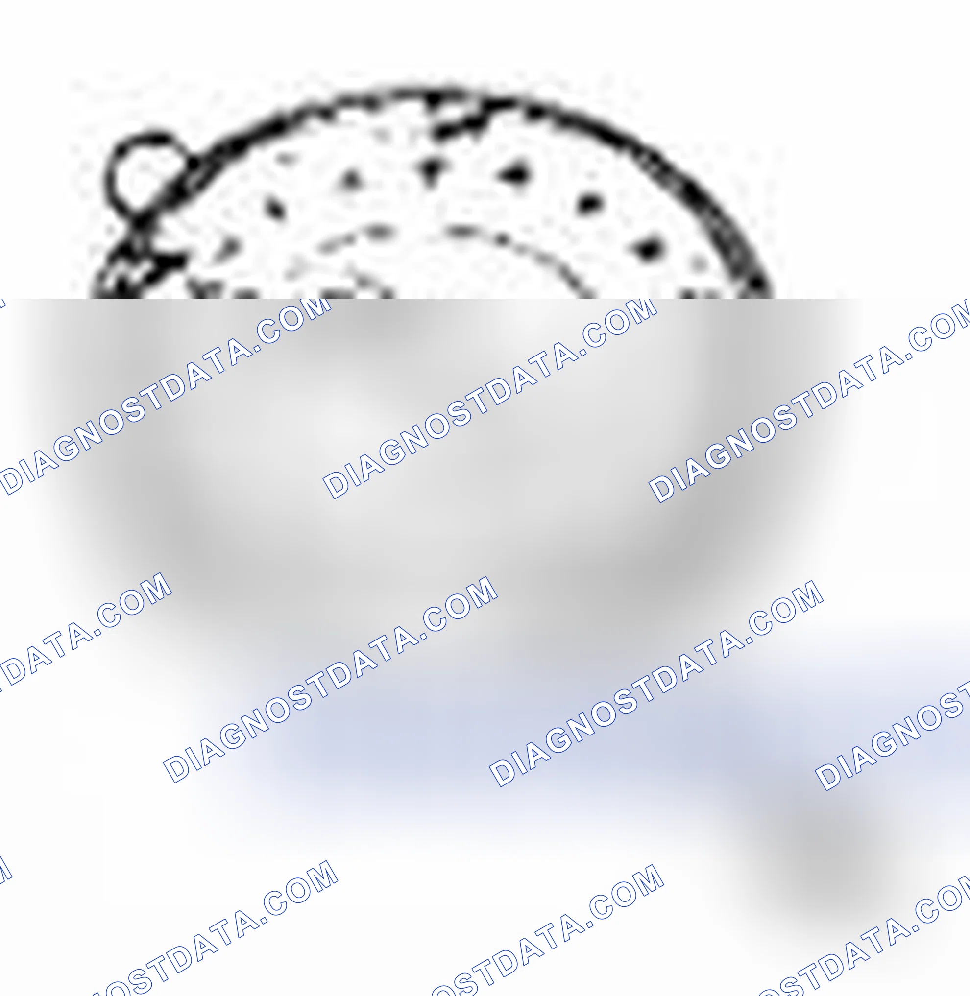 Scheme 51: Special Tool