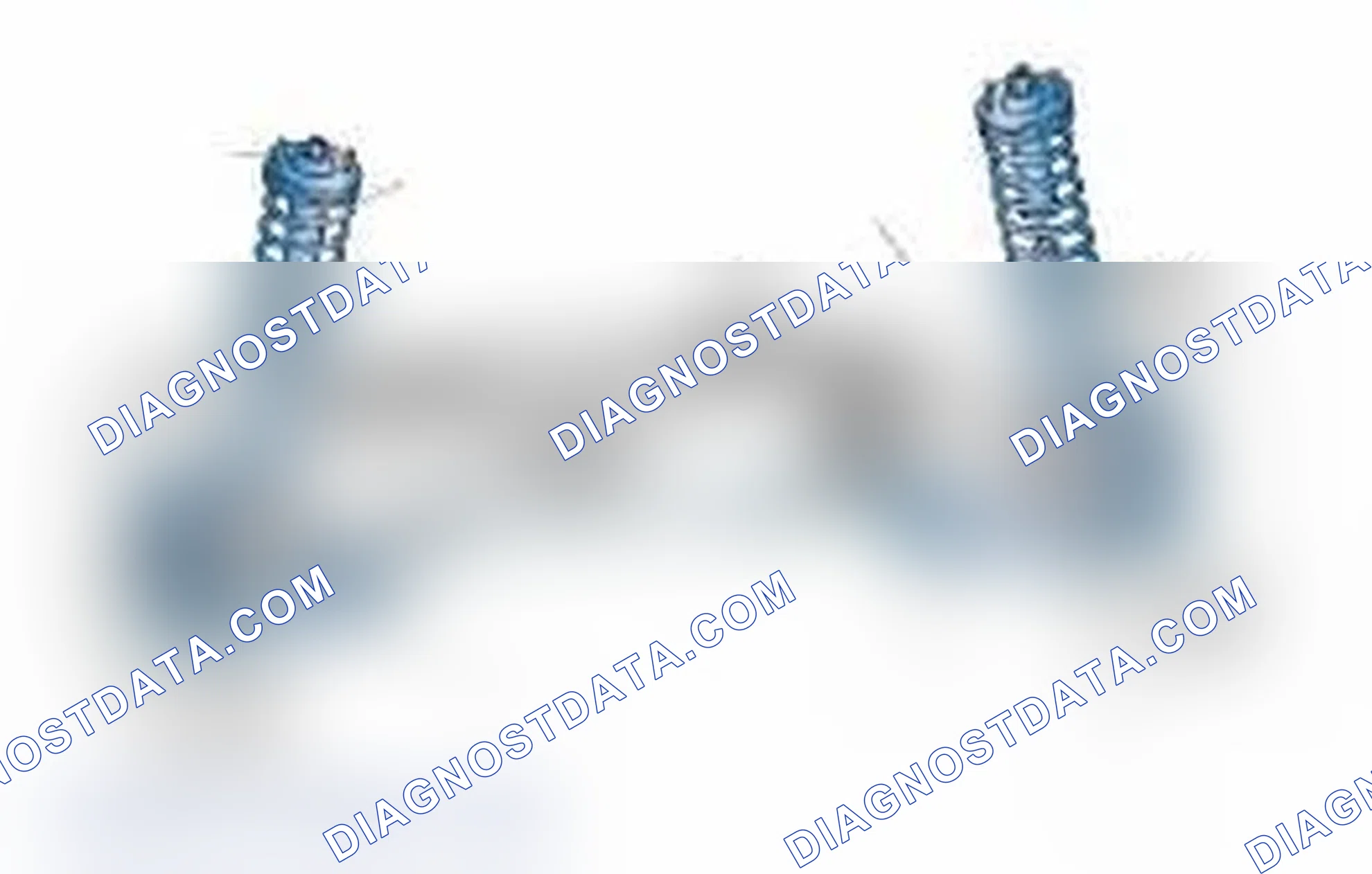 Scheme 25: Typical Front Suspension & Steering Components