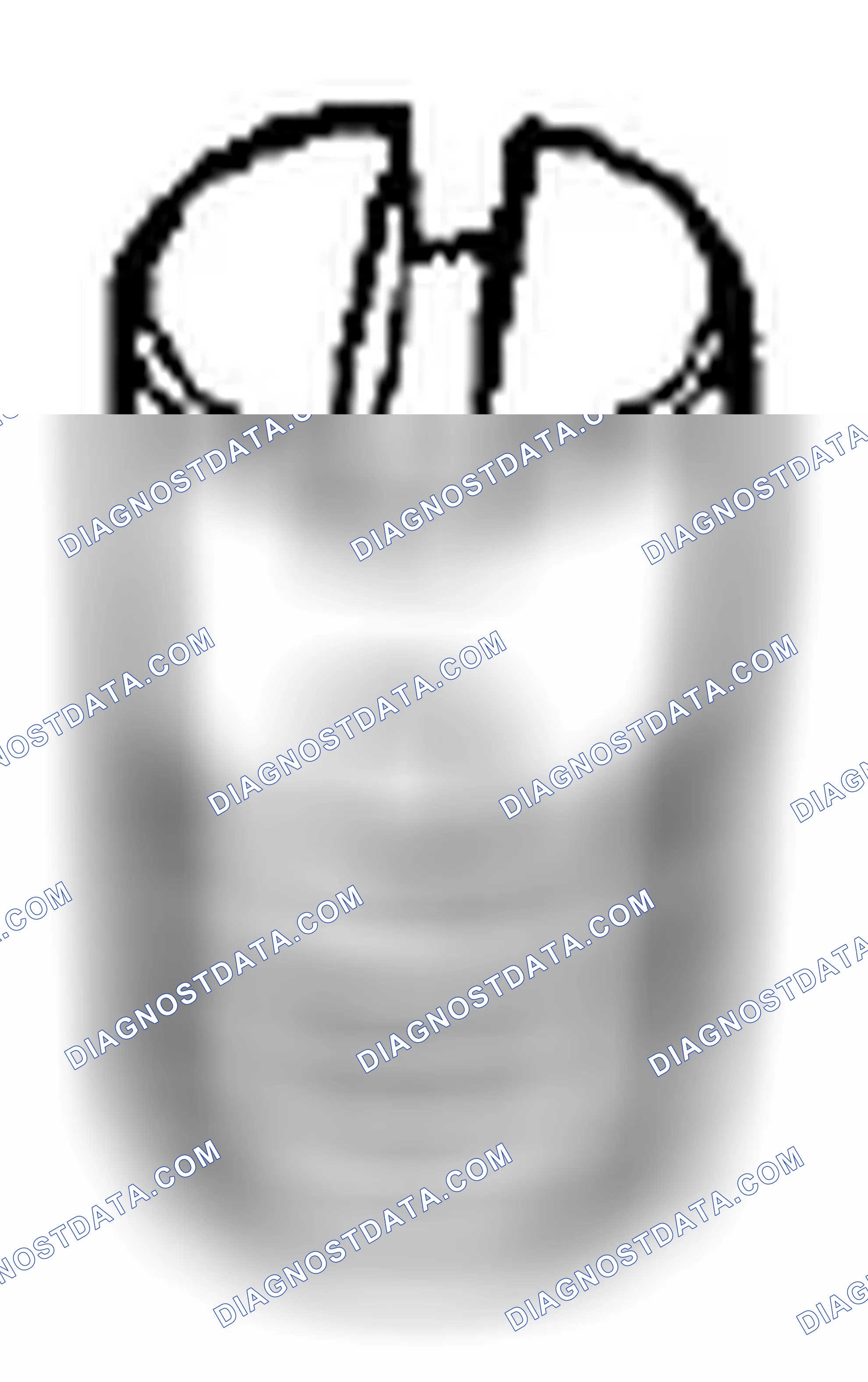 Scheme 161: Oil Relief Valve