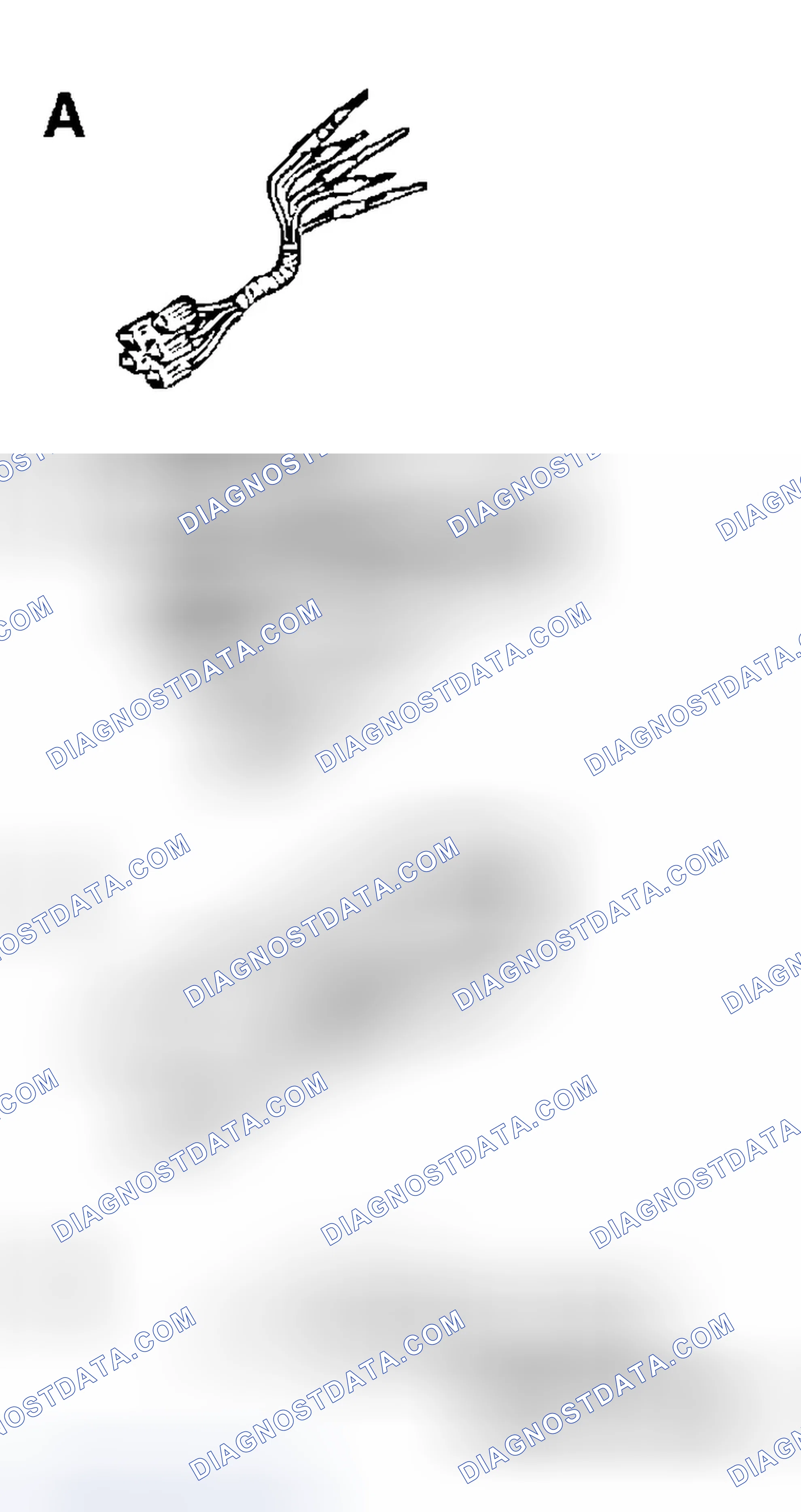 Scheme 244: SPECIAL TOOL