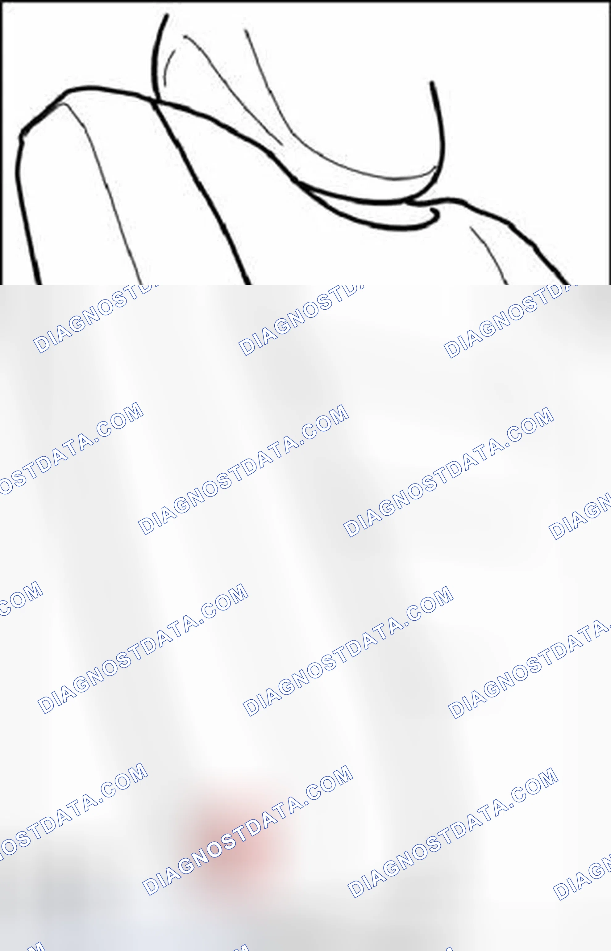 Scheme 120: Removing bushing for center bearing