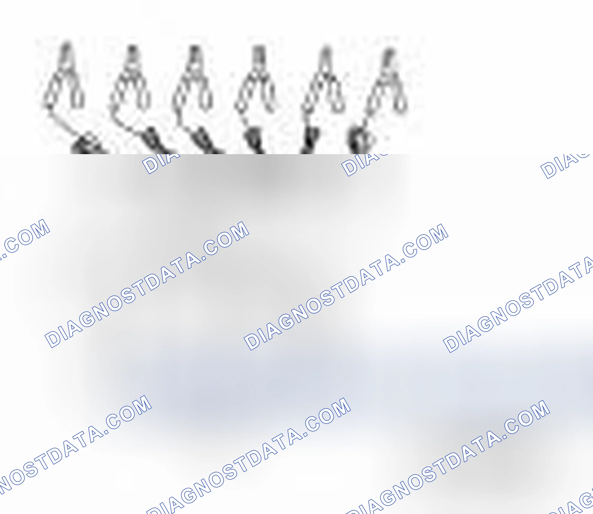 Scheme 87: Special Service Tools