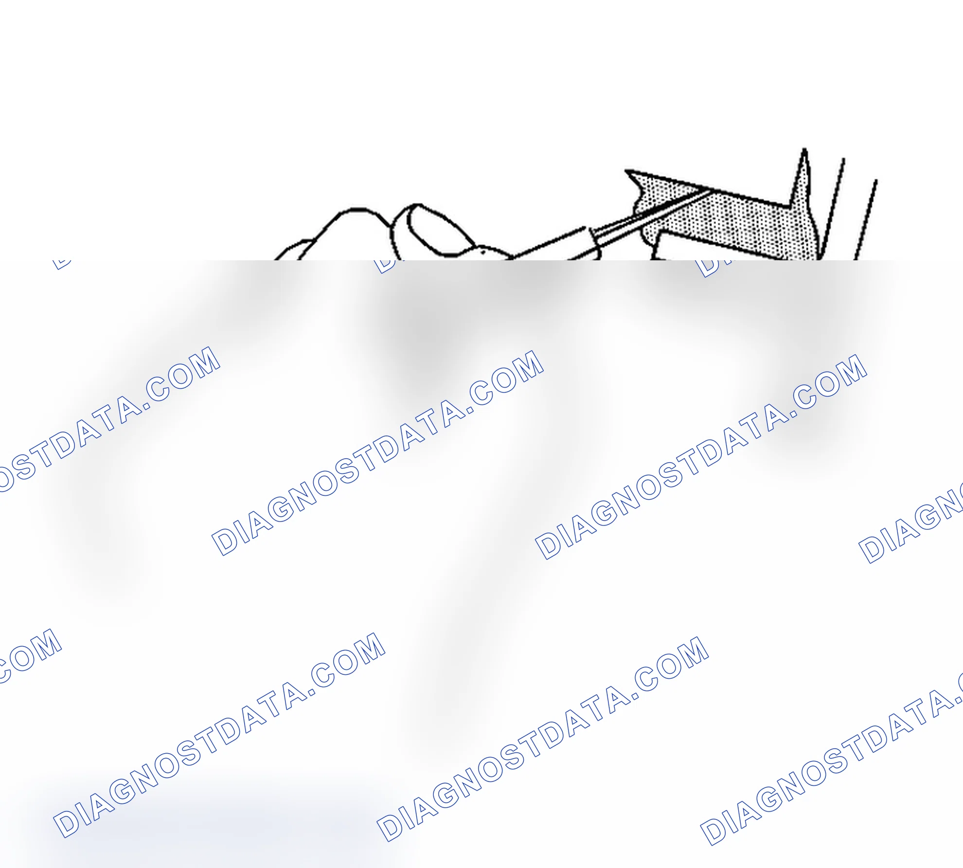 Scheme 5: Body Waterleak Repair